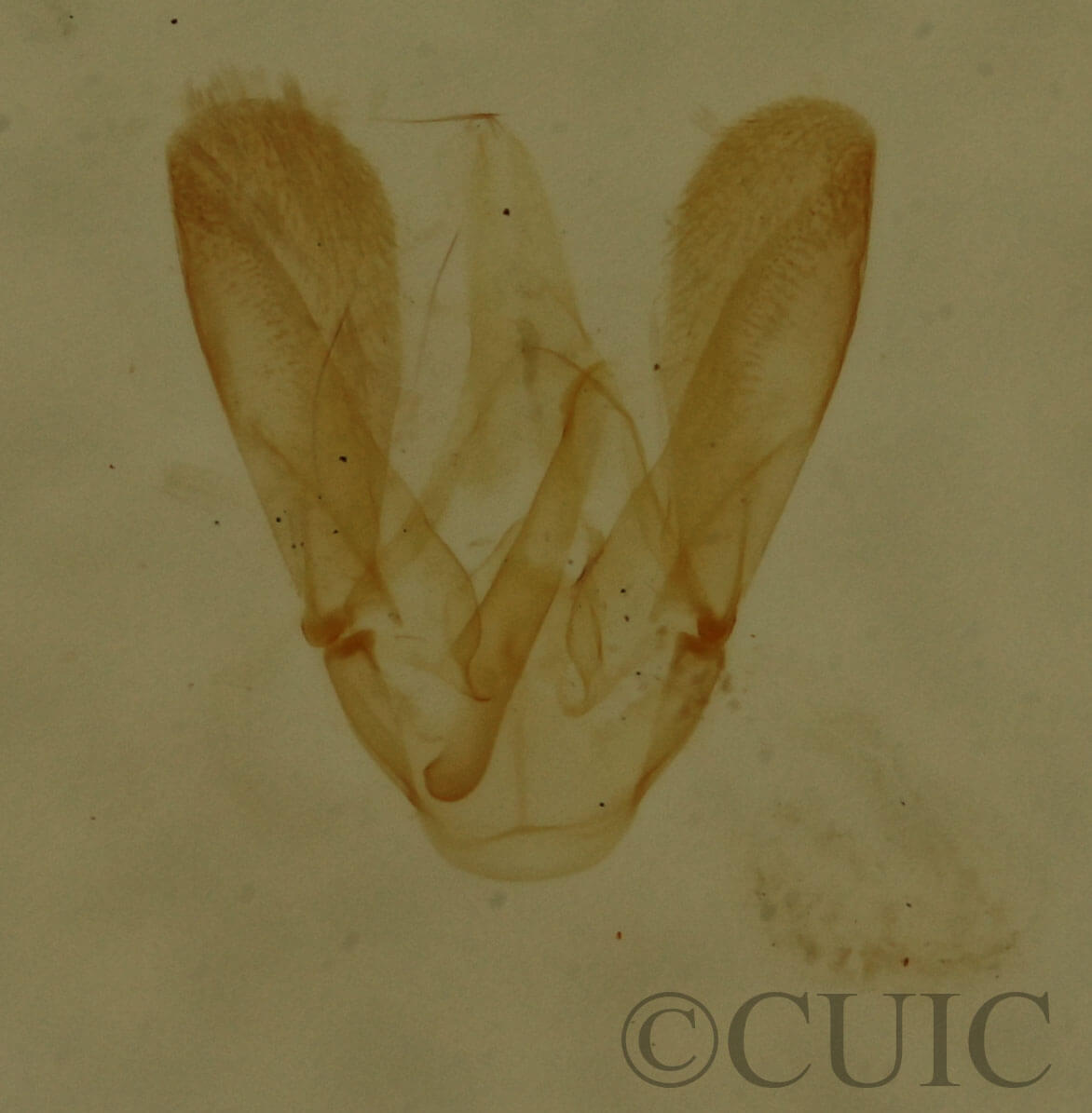 genitalia view of adult Choreutis pariana