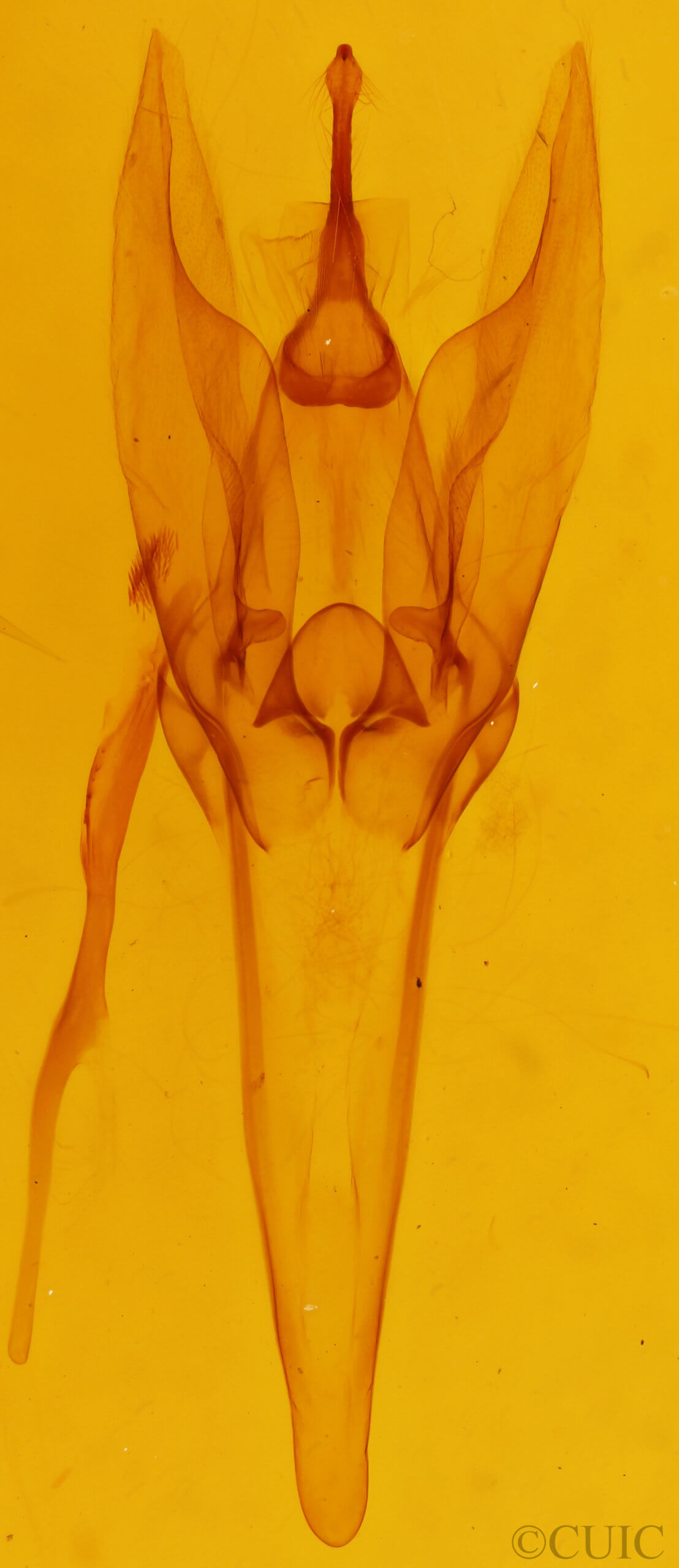 genitalia view of adult Daddala microdesma