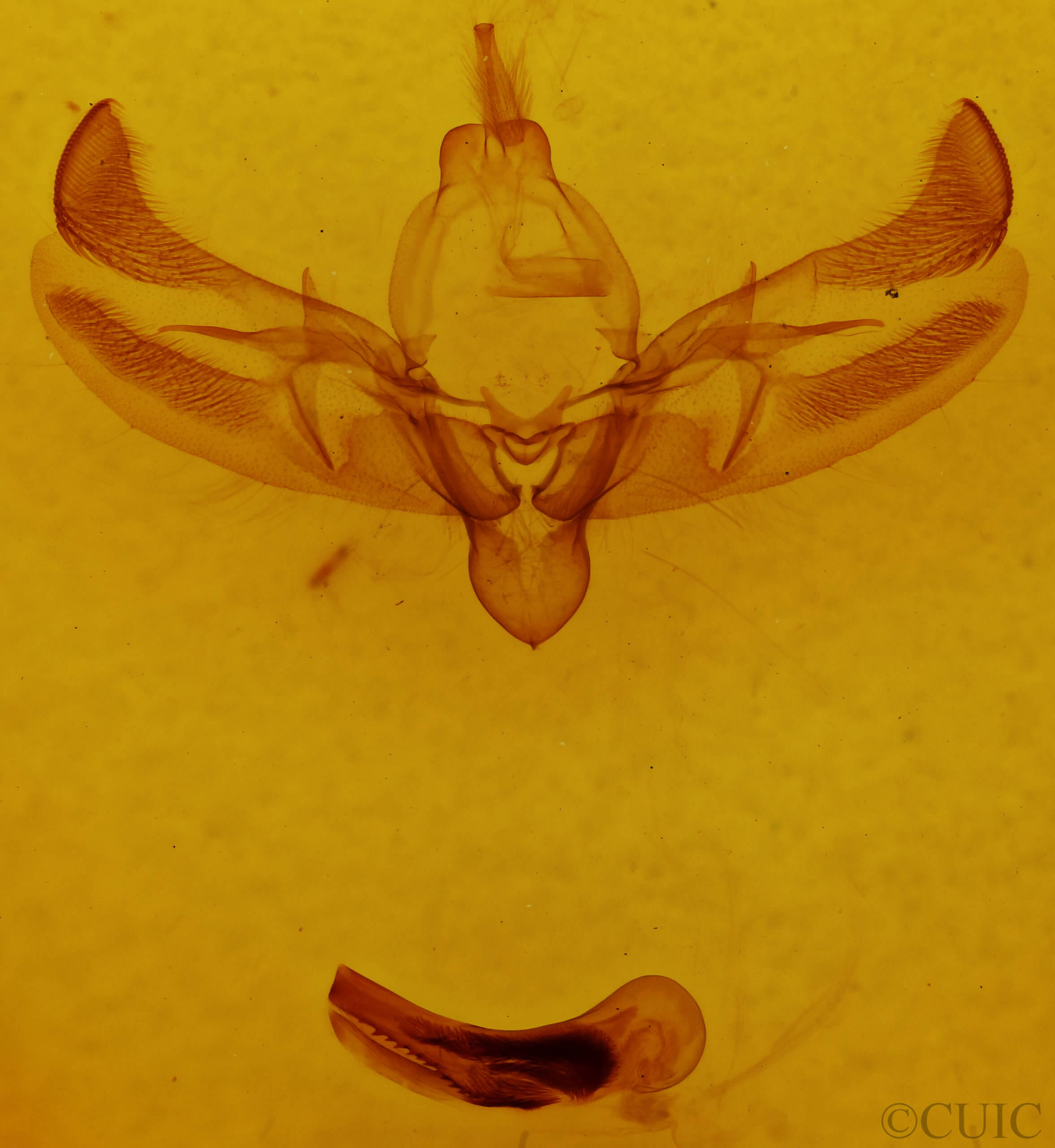 genitalia view of adult Diarsia