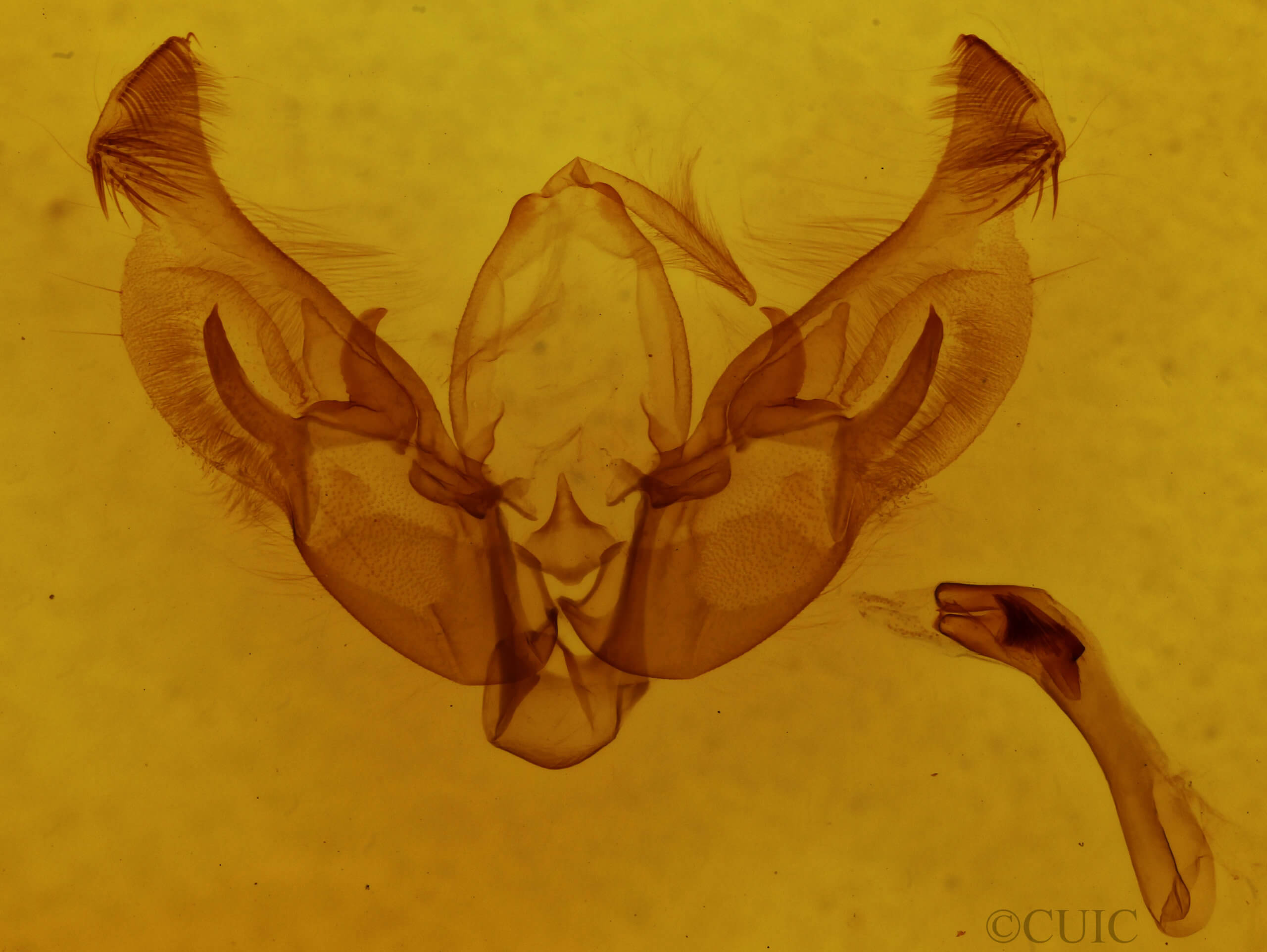 genitalia view of adult Diarsia
