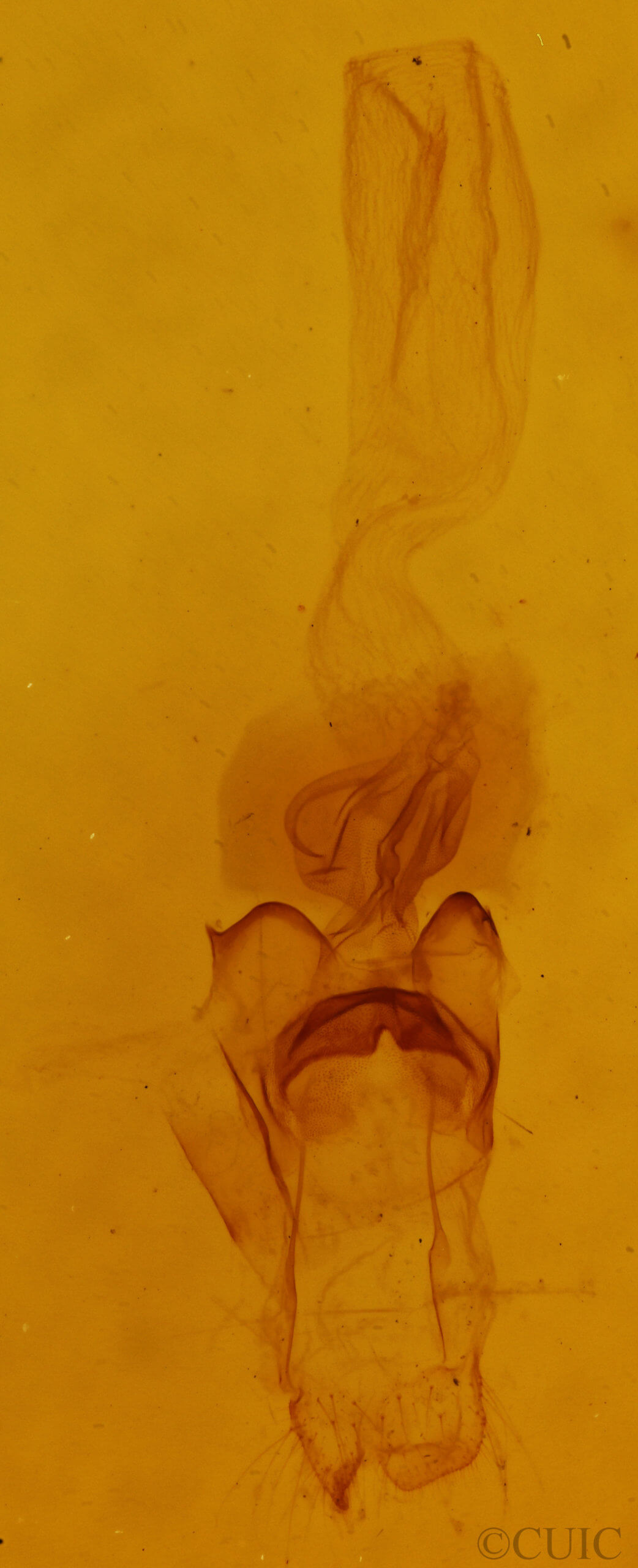 genitalia view of adult Diarsia