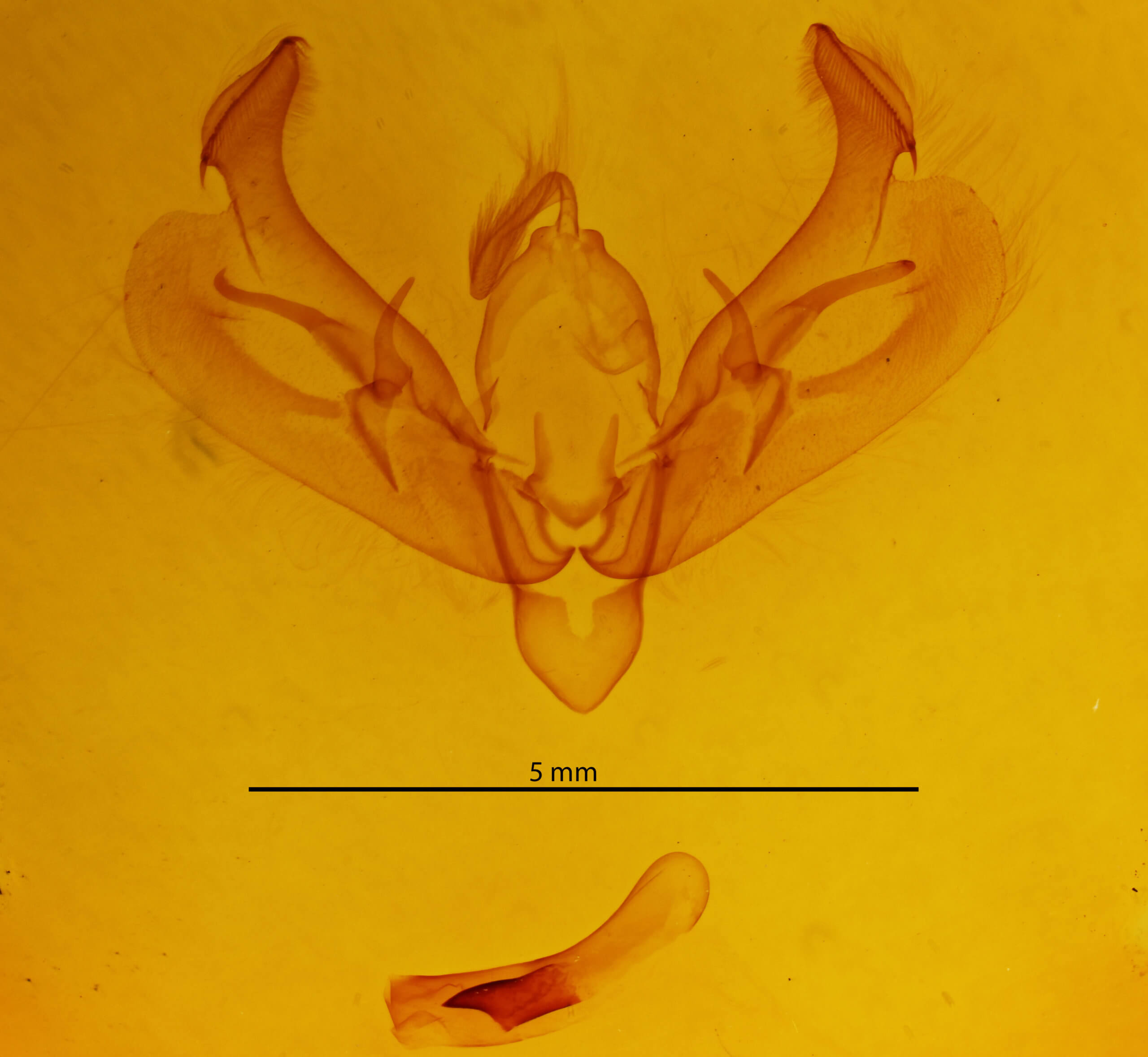 genitalia view of adult Diarsia brunnea