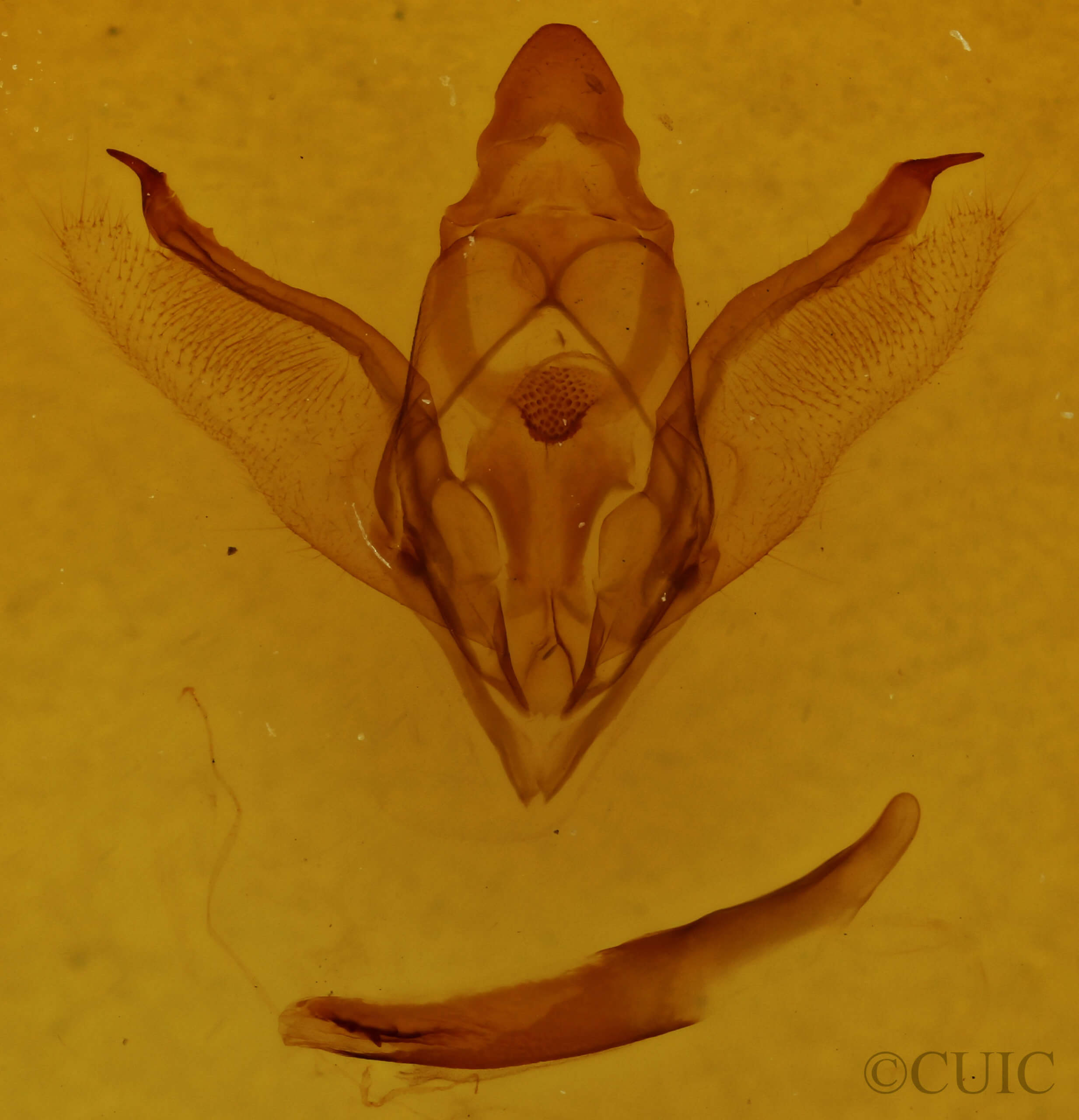 genitalia view of adult Enypia venata