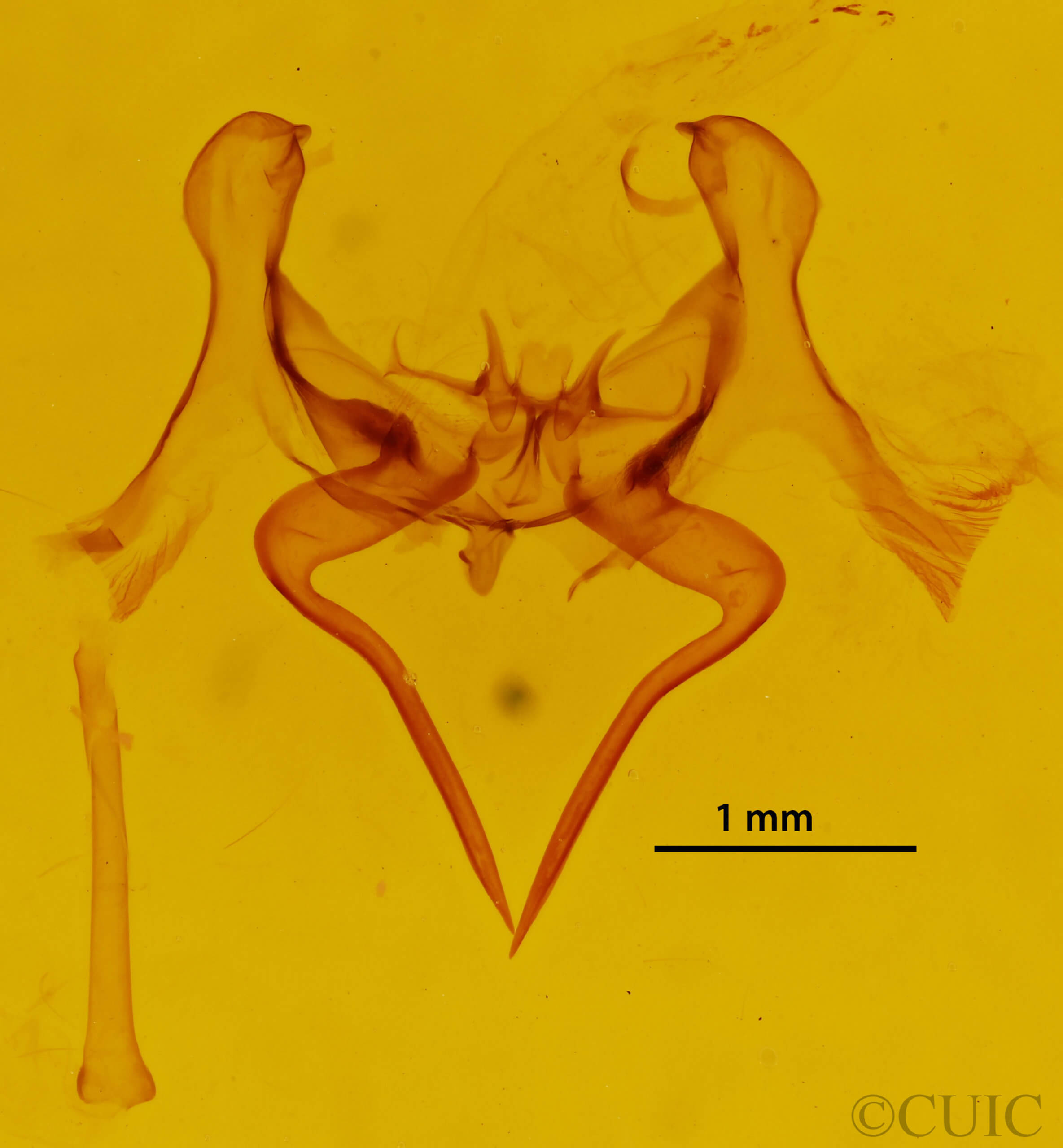 genitalia view of adult Epia muscosa