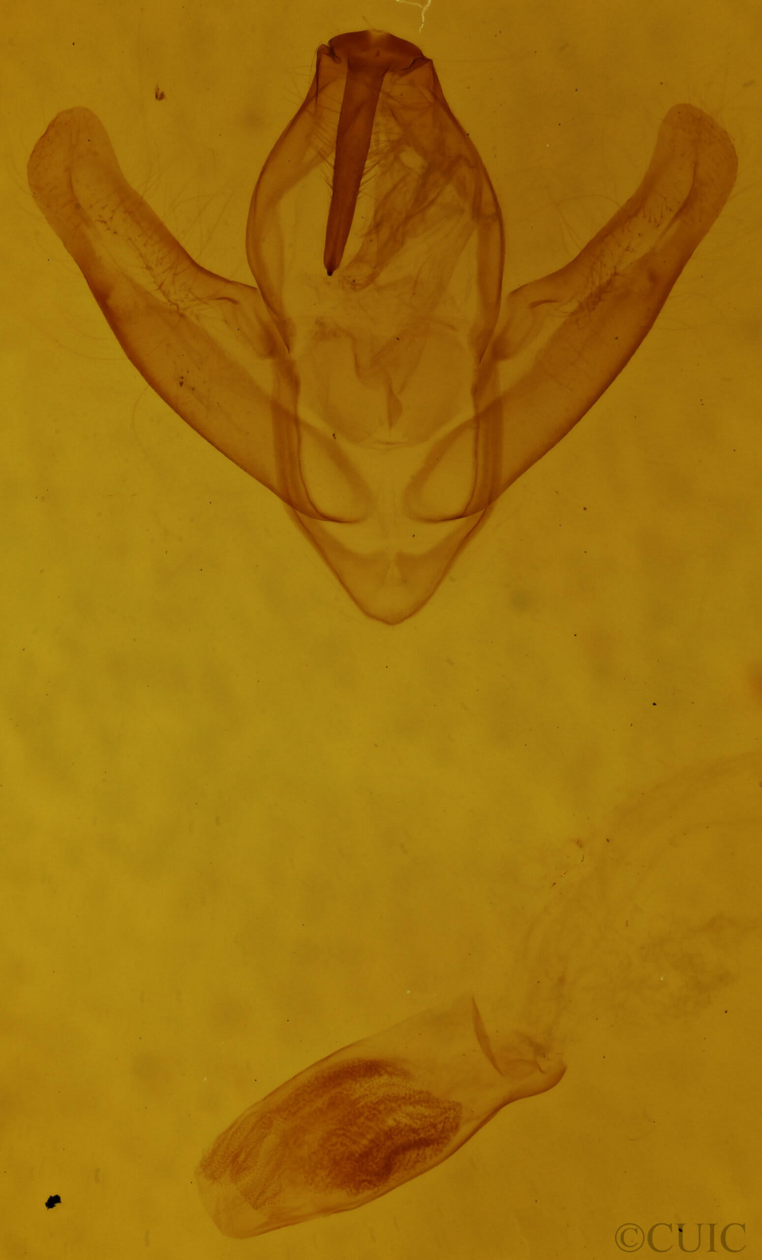 genitalia view of adult Episparis angulatilinea