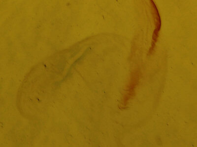 genitalia view of adult Eupsilia vinulenta