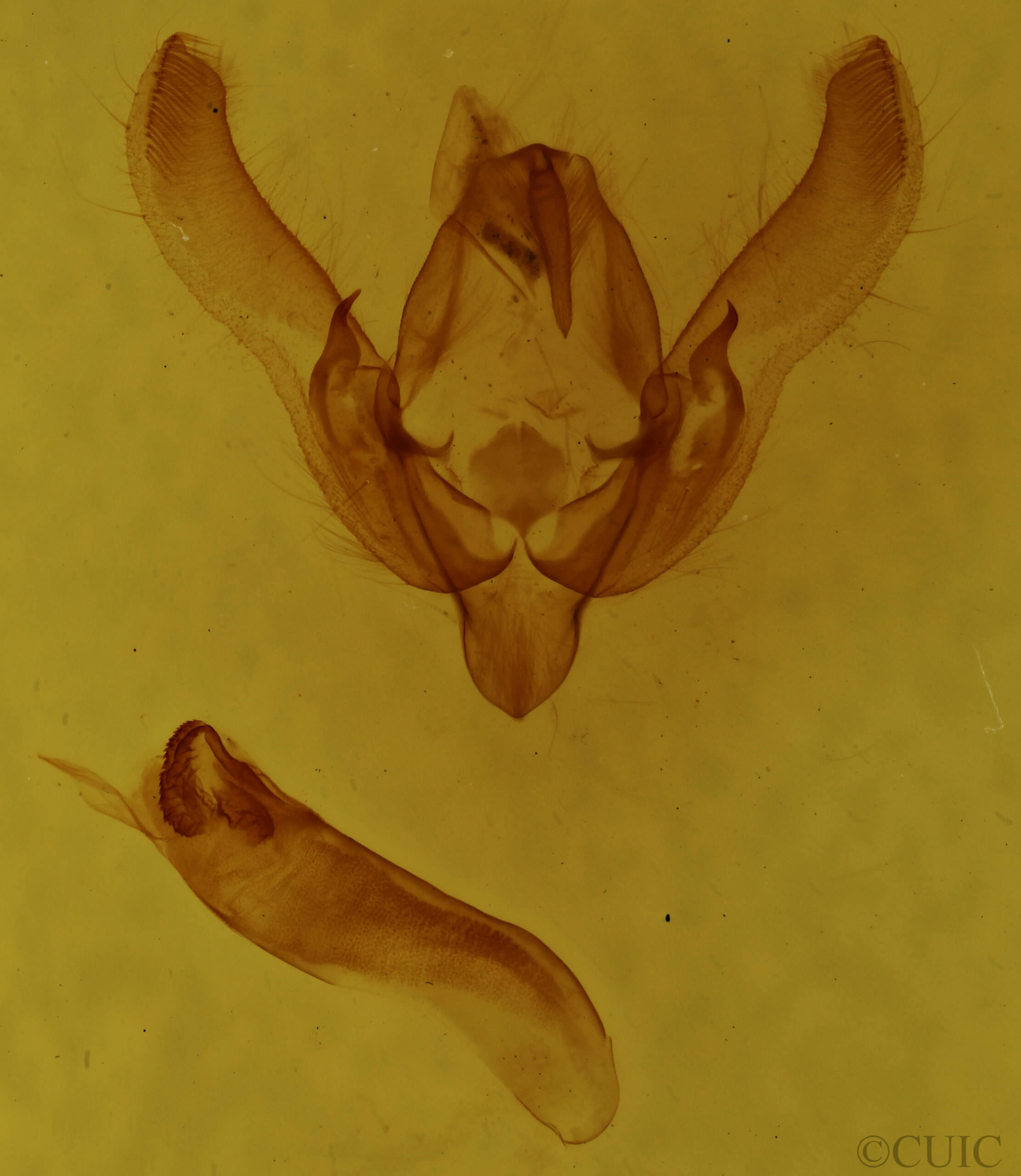 genitalia view of adult Agrotis admirationis