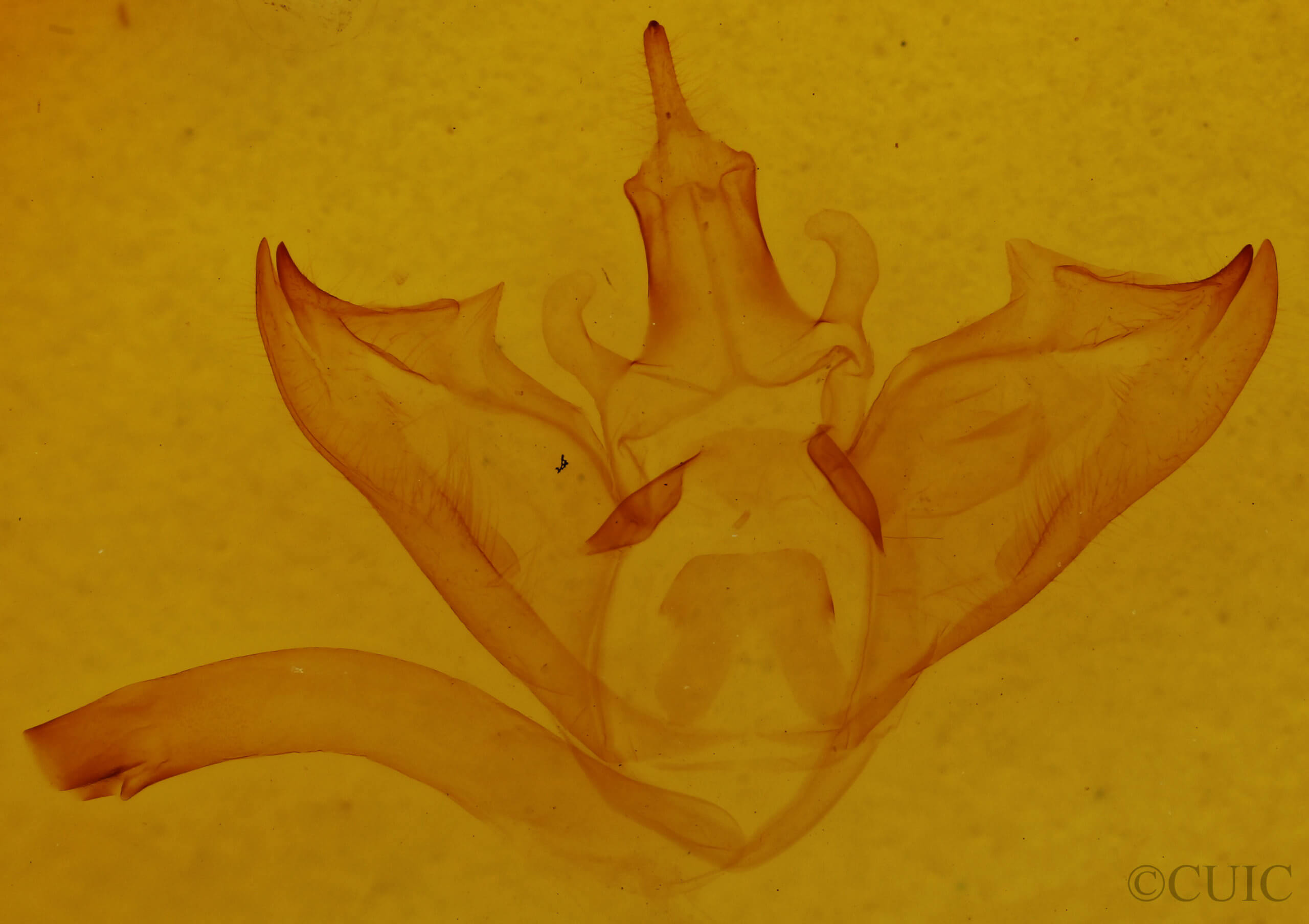 genitalia view of adult Halysidota harrisii