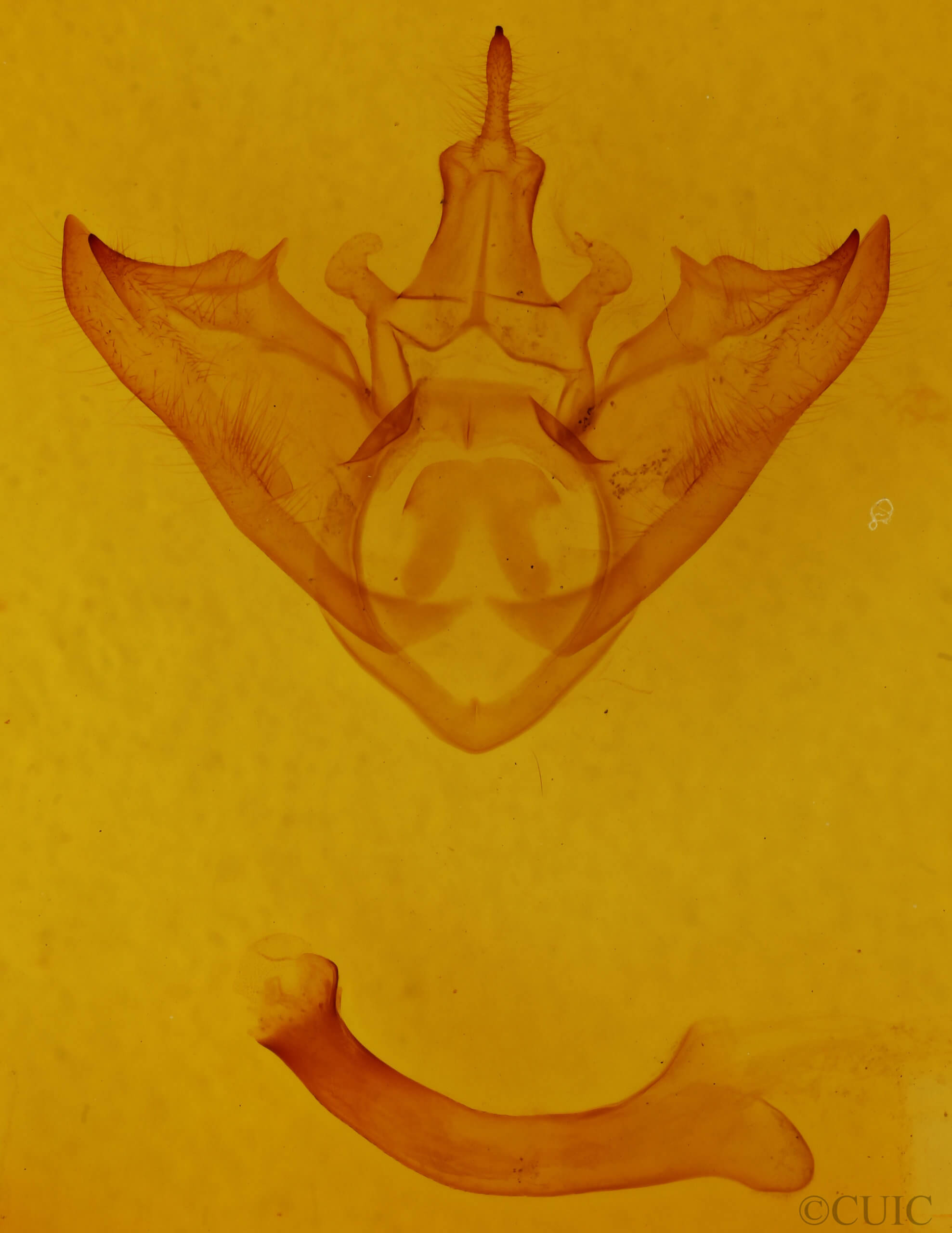 genitalia view of adult Halysidota harrisii