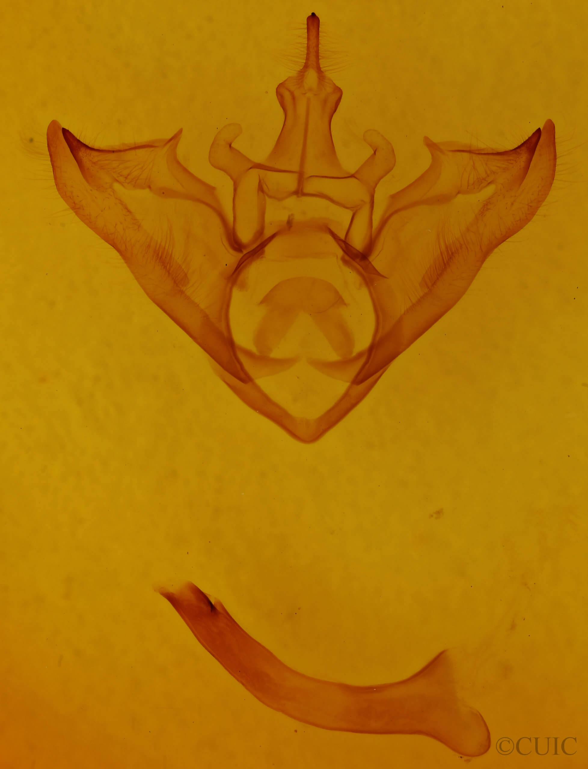 genitalia view of adult Halysidota harrisii