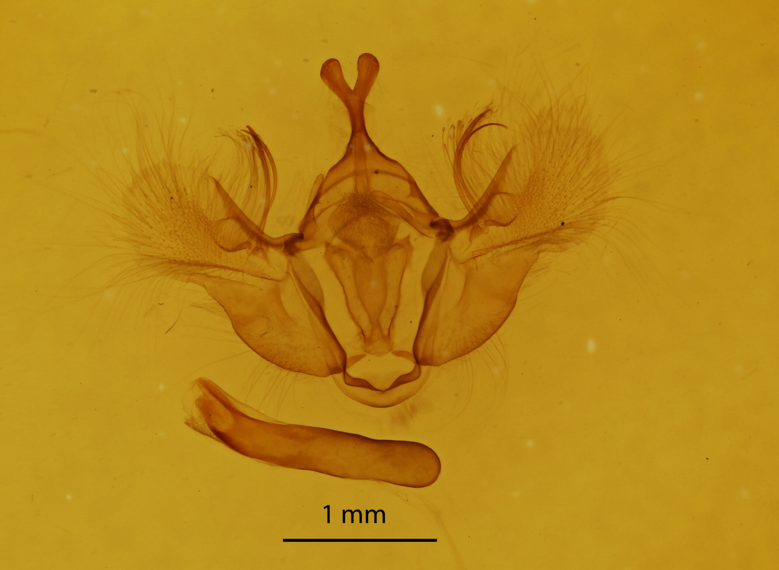 genitalia view of adult Hydriomena ruberata