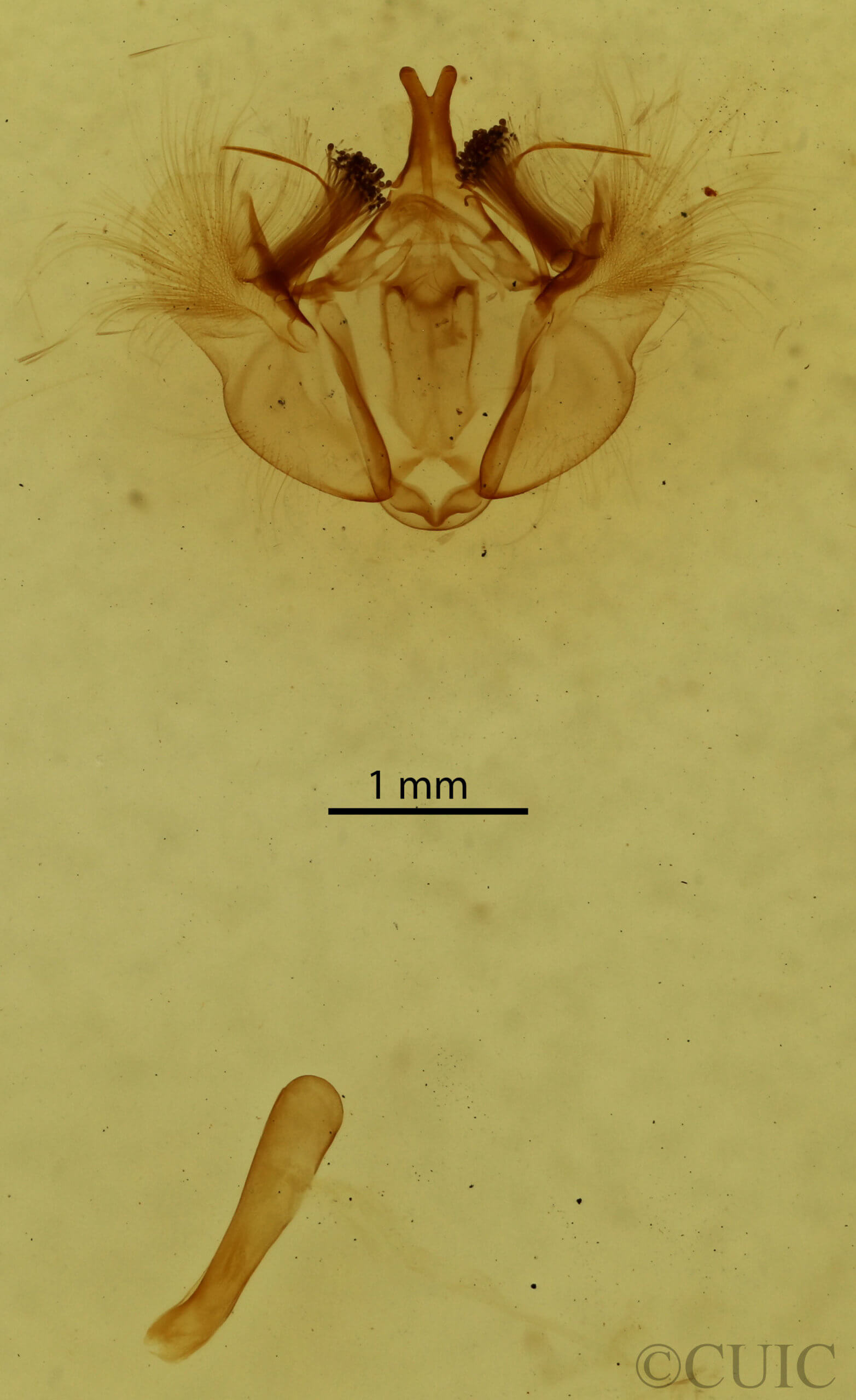 genitalia view of adult Hydriomena transfigurata manitoba