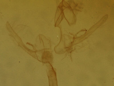 genitalia view of adult Hypenodes