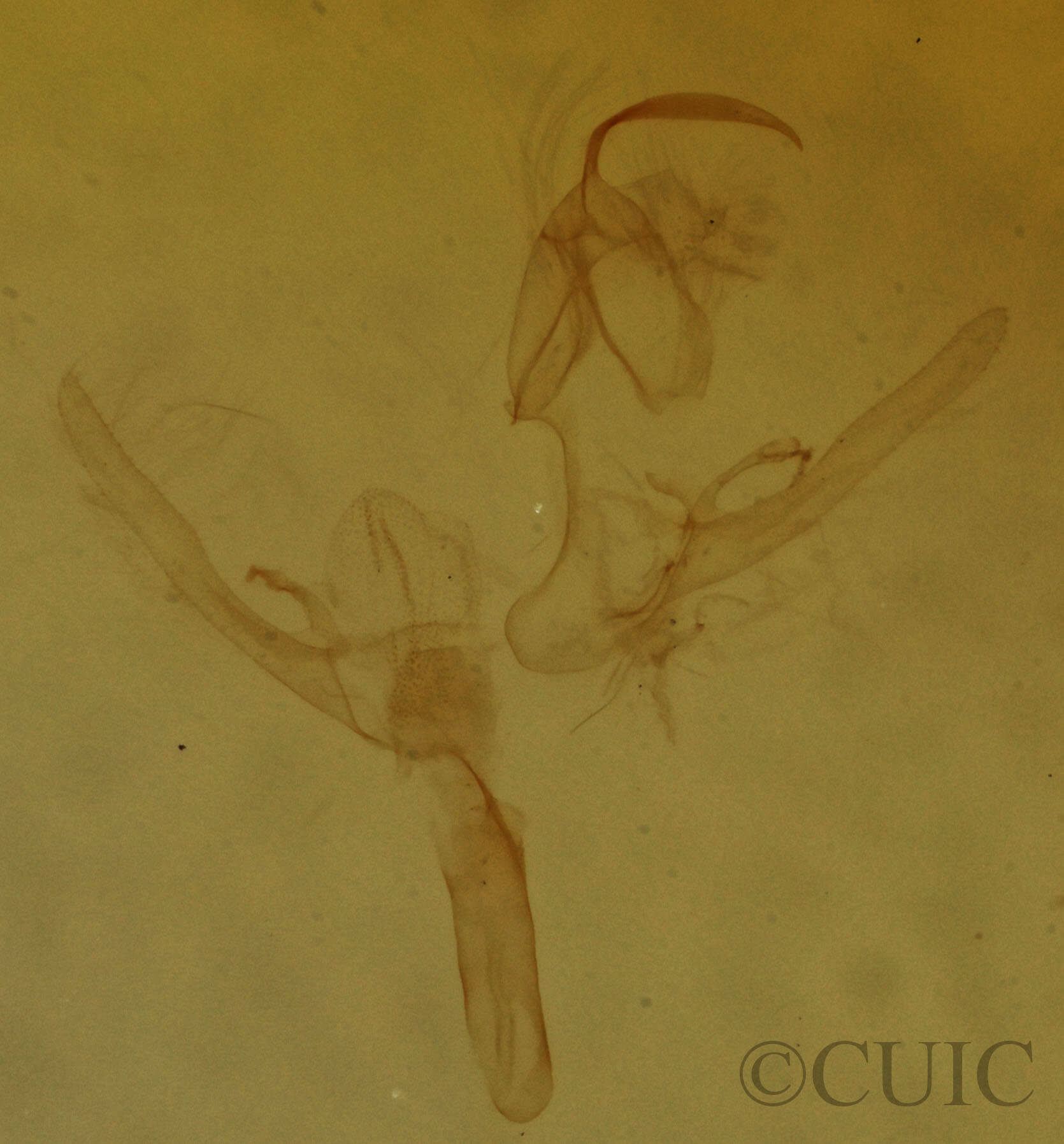 genitalia view of adult Hypenodes