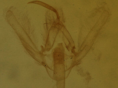 genitalia view of adult Hypenodes