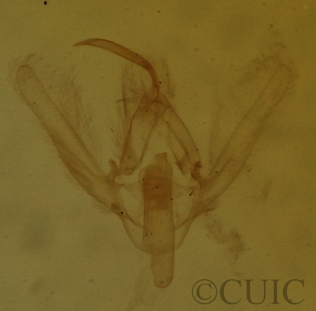 genitalia view of adult Hypenodes