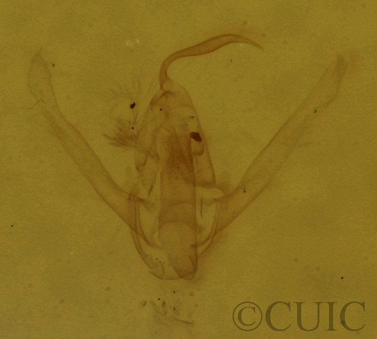 genitalia view of adult Hypenodes