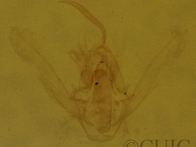 genitalia view of adult Hypenodes