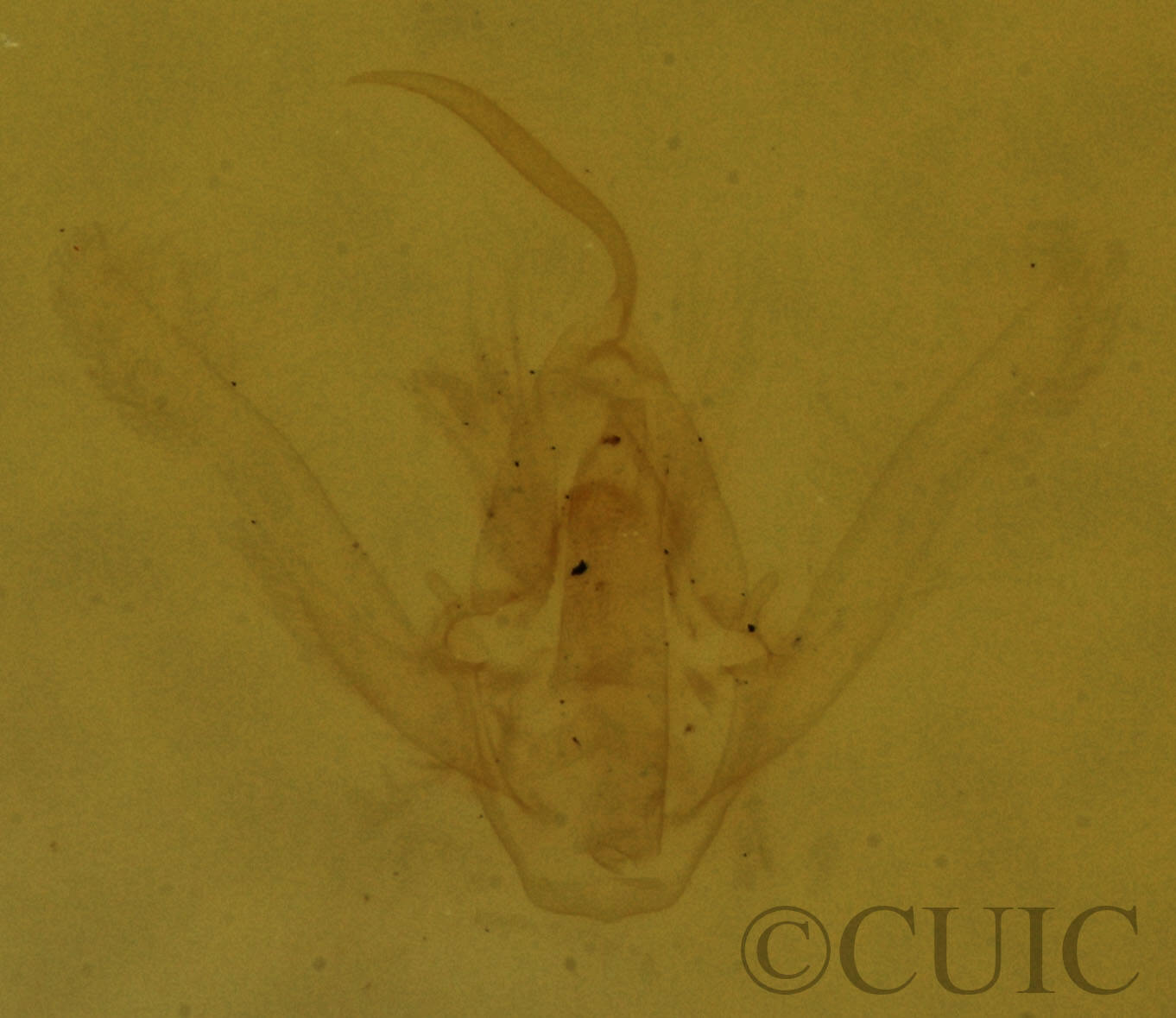 genitalia view of adult Hypenodes