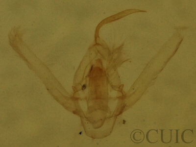 genitalia view of adult Hypenodes