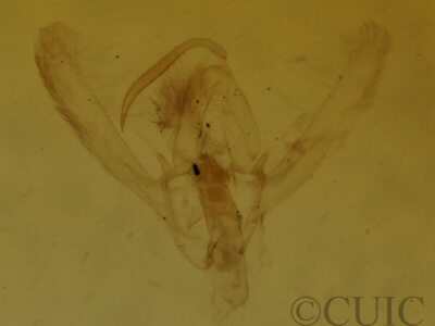 genitalia view of adult Hypenodes