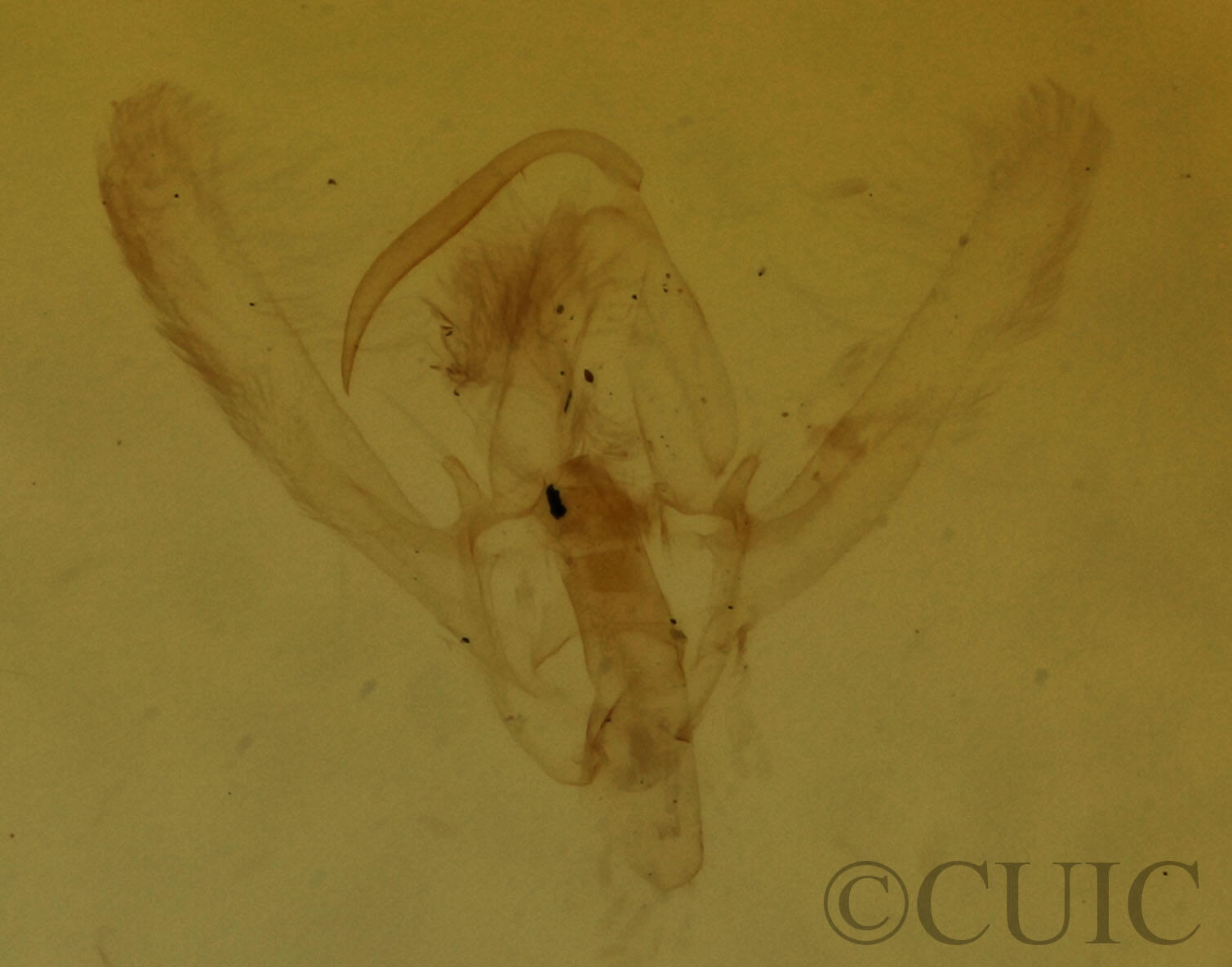 genitalia view of adult Hypenodes
