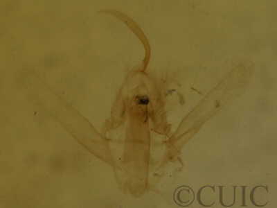 genitalia view of adult Hypenodes