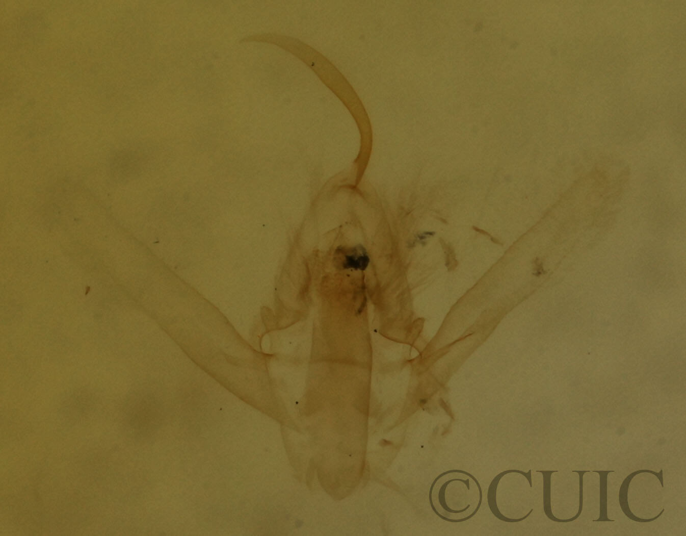 genitalia view of adult Hypenodes