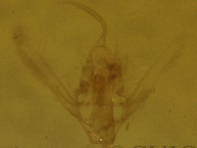 genitalia view of adult Hypenodes