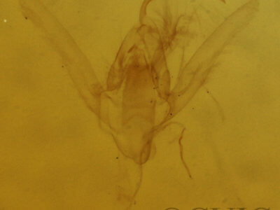 genitalia view of adult Hypenodes