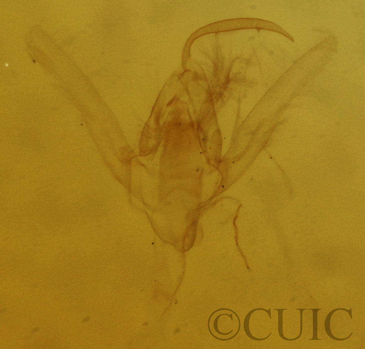 genitalia view of adult Hypenodes