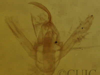 genitalia view of adult Hypenodes