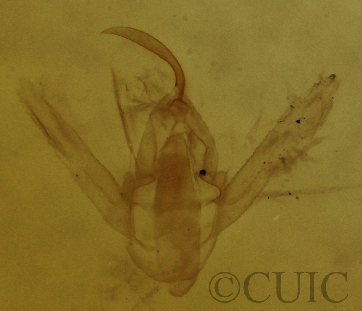 genitalia view of adult Hypenodes