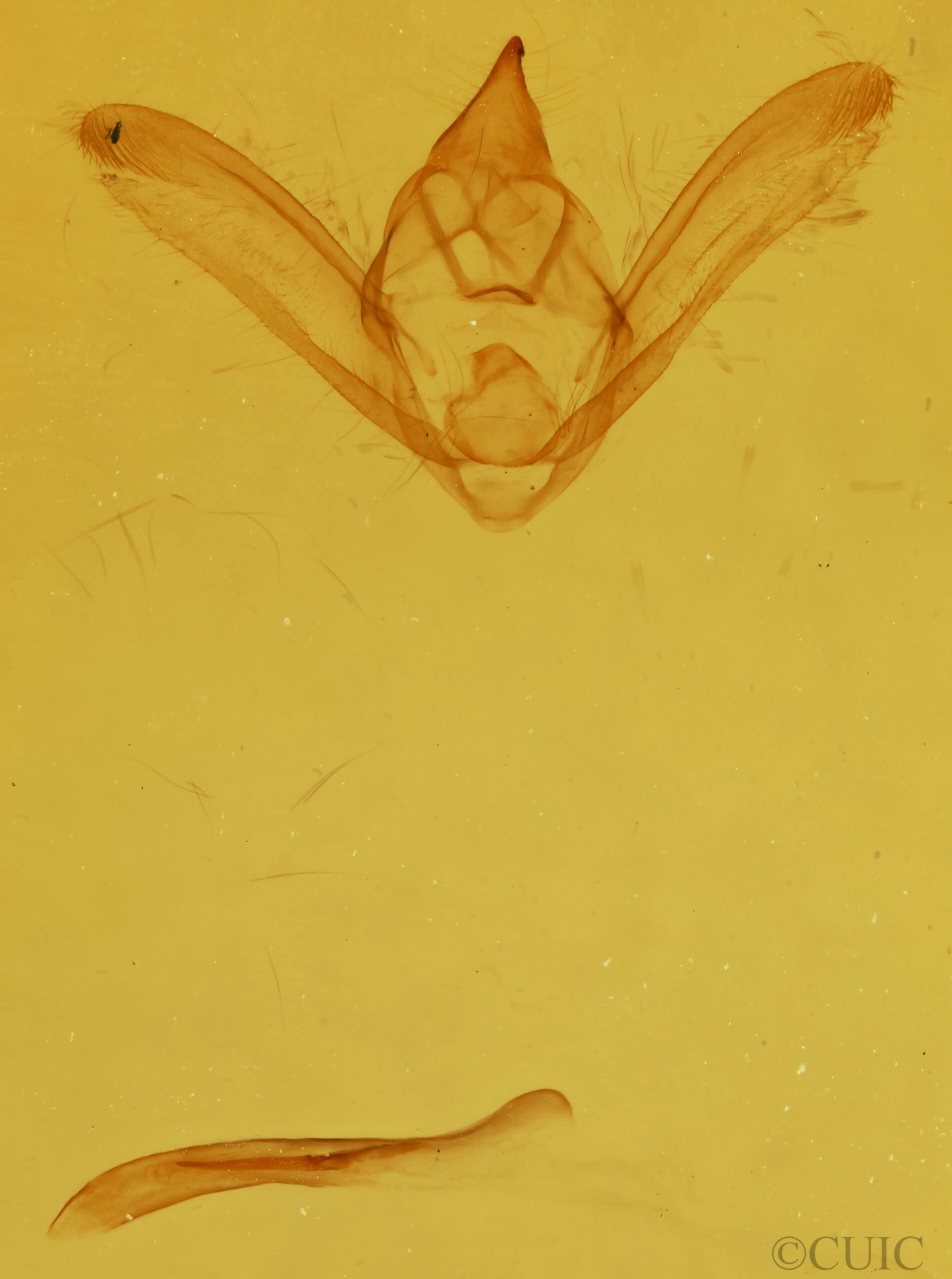 genitalia view of adult Hyposidra