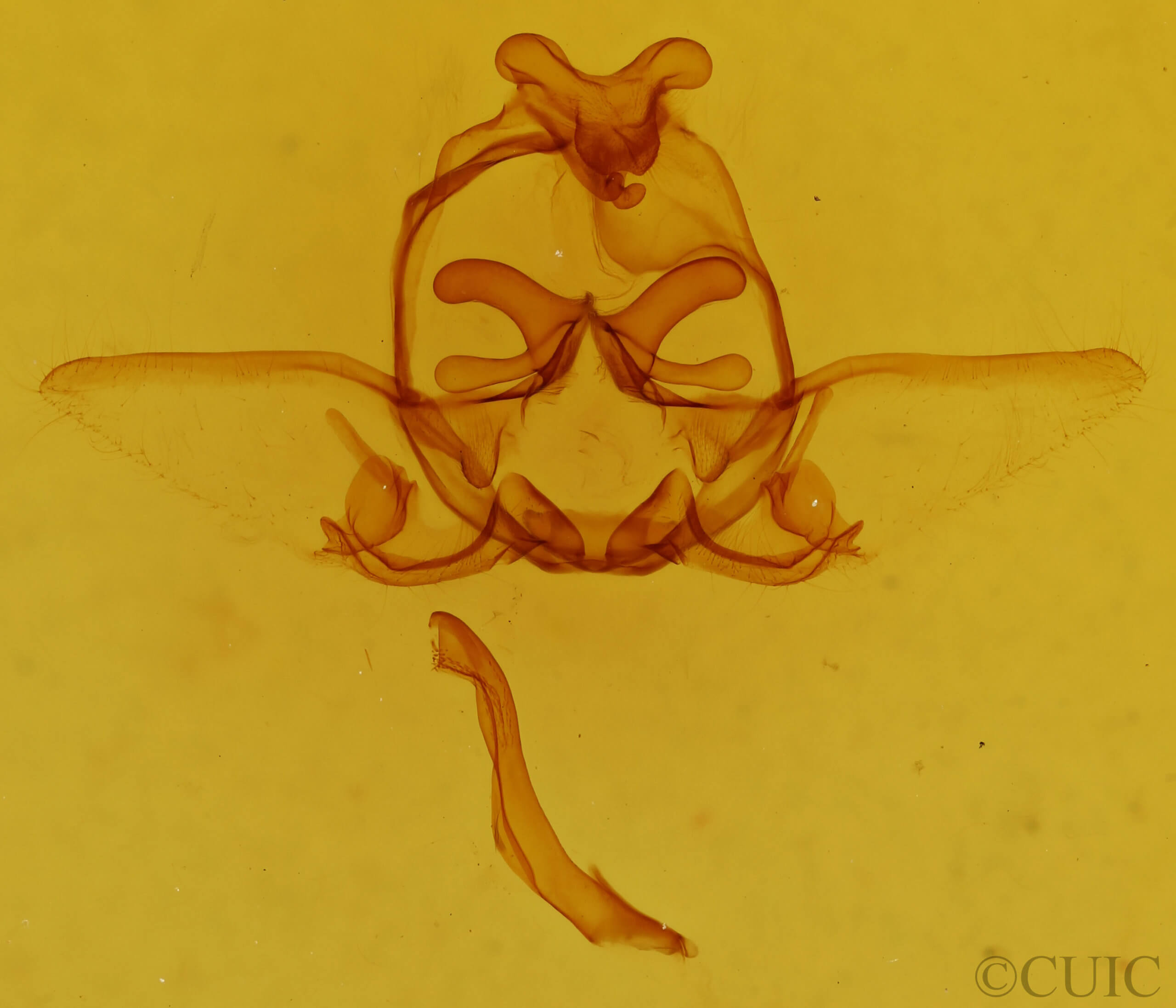 genitalia view of adult Kikuchiana ocularis