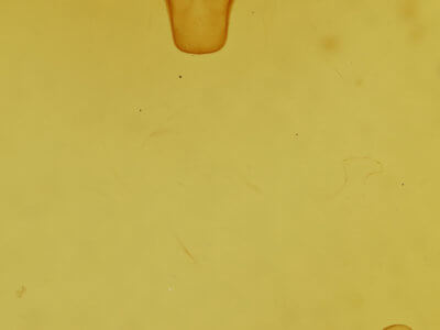 genitalia view of adult Lemmeria digitalis