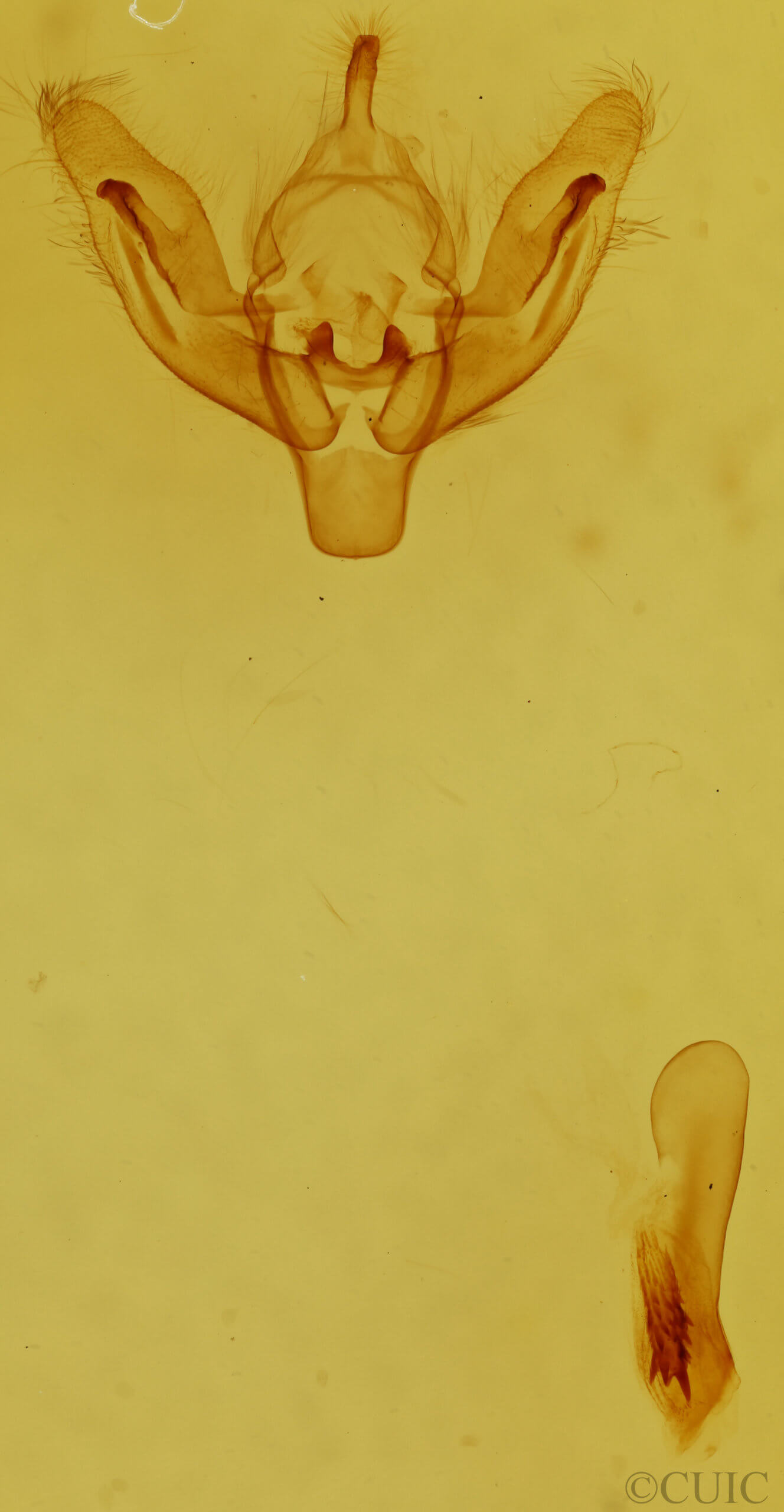 genitalia view of adult Lemmeria digitalis