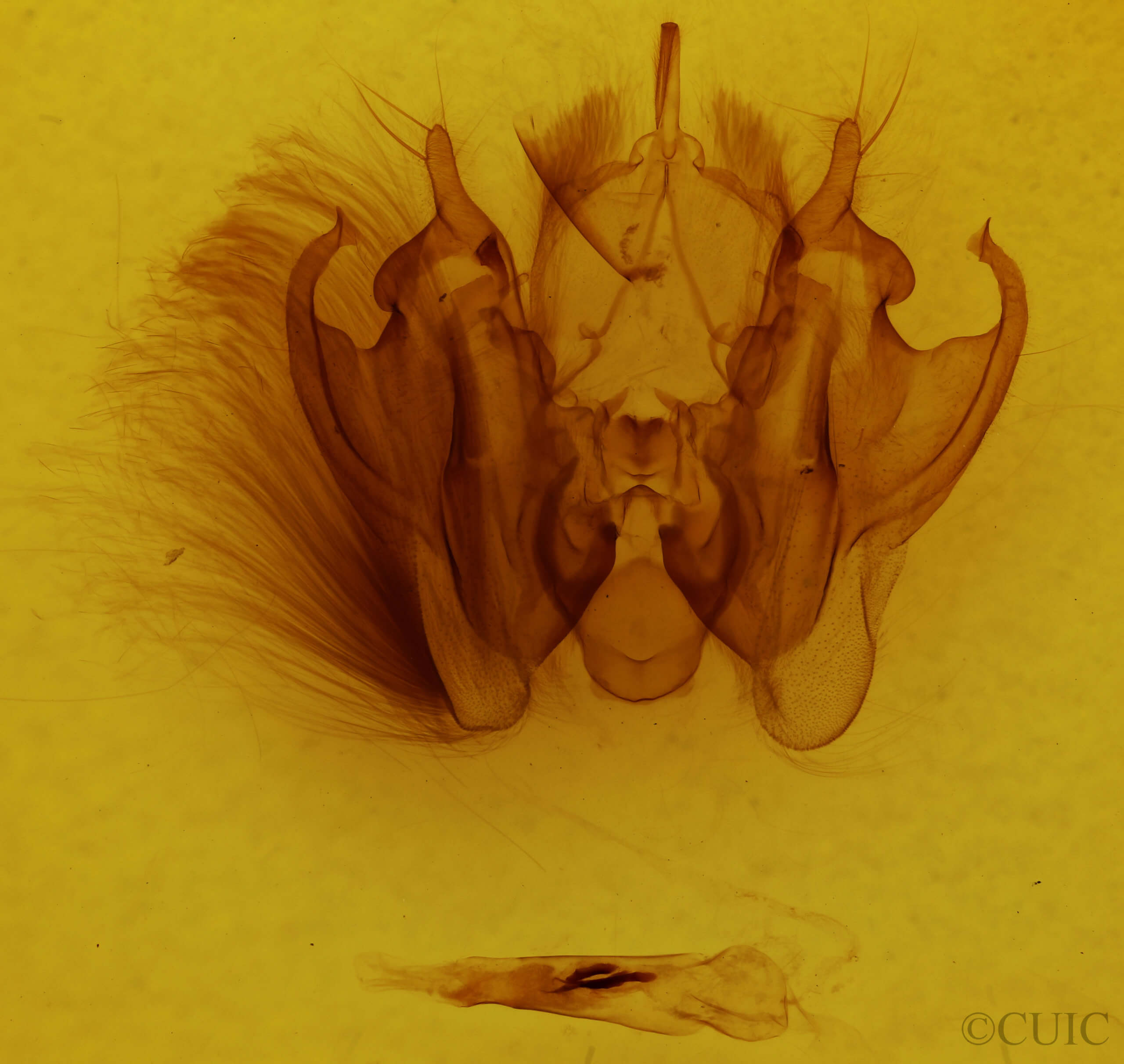 genitalia view of adult Leucania