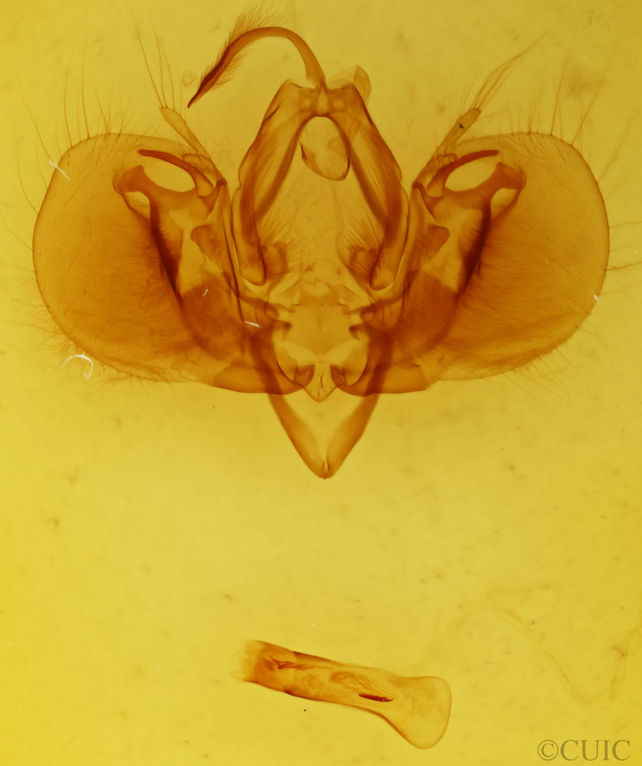 genitalia view of adult Leucania celebensis