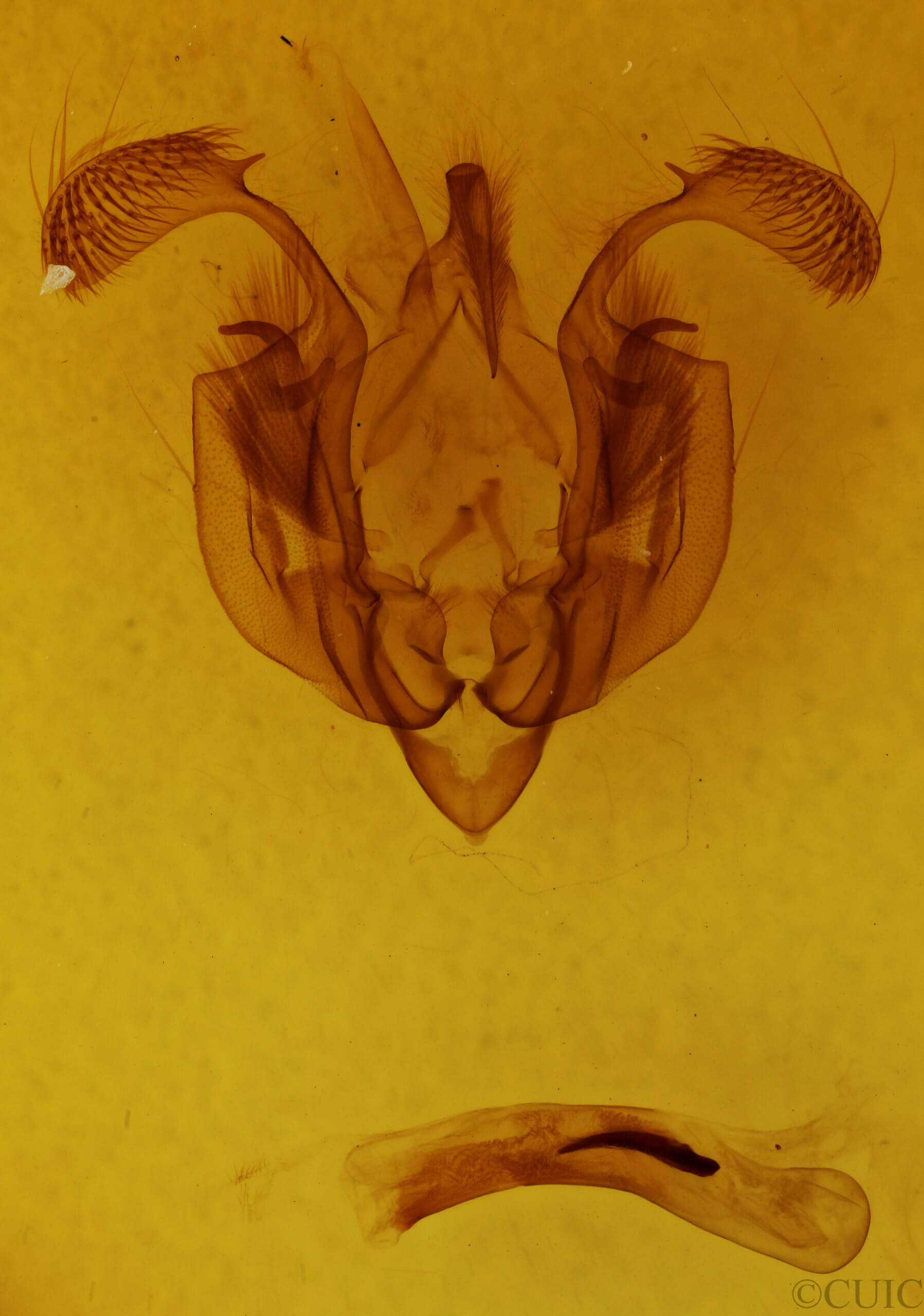 genitalia view of adult Leucania formosana