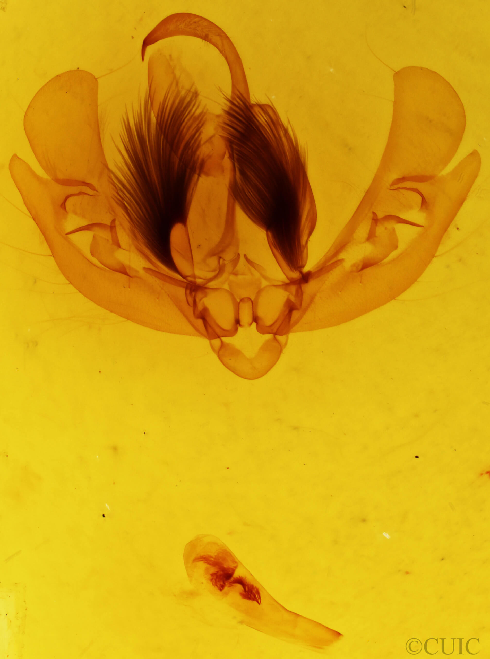 genitalia view of adult Leucania yu