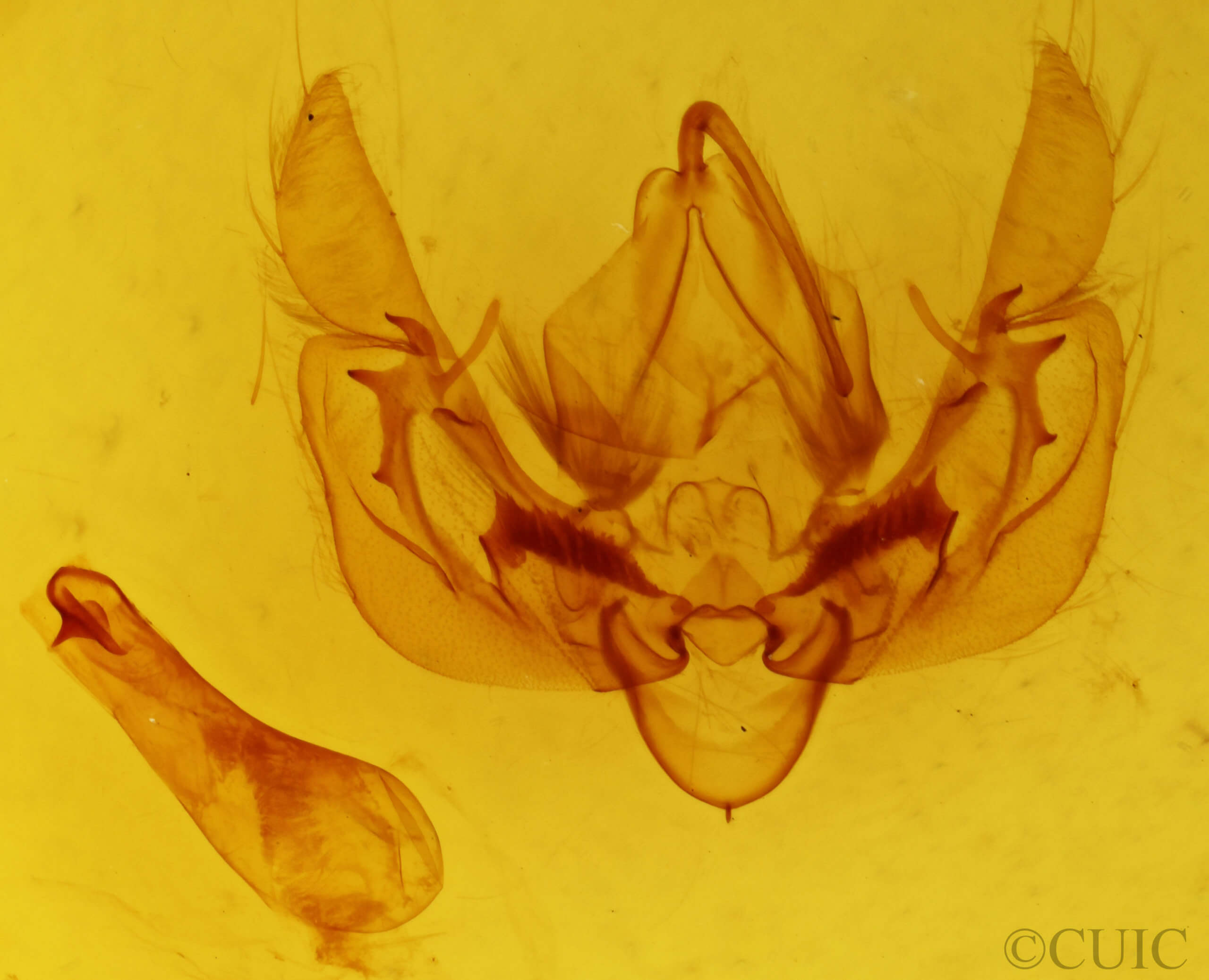 genitalia view of adult Leucania roselinea