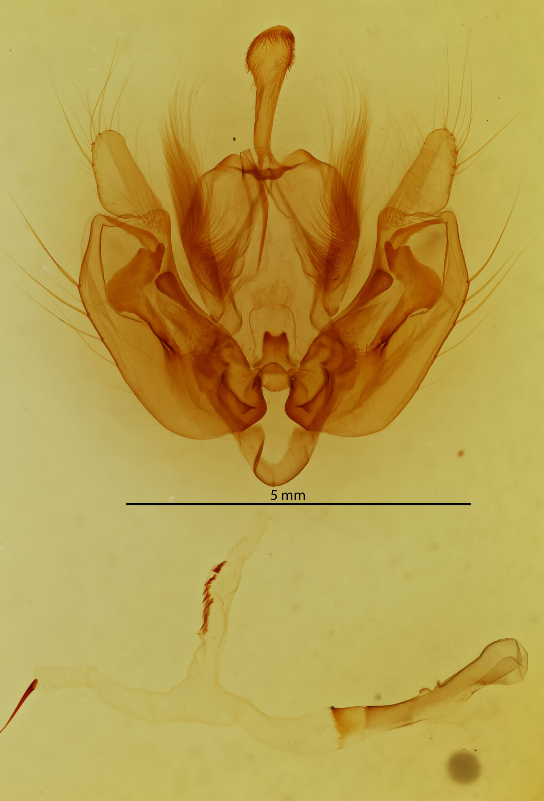 genitalia view of adult Leucania ursula
