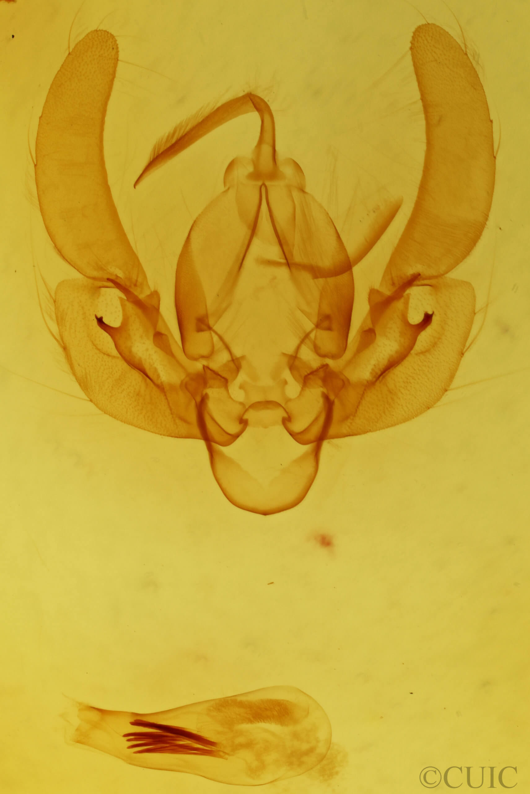 genitalia view of adult Leucania venalba