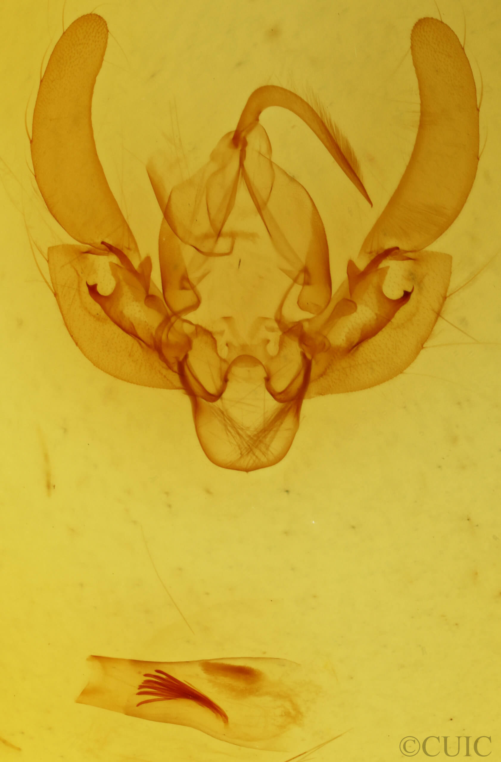 genitalia view of adult Leucania venalba