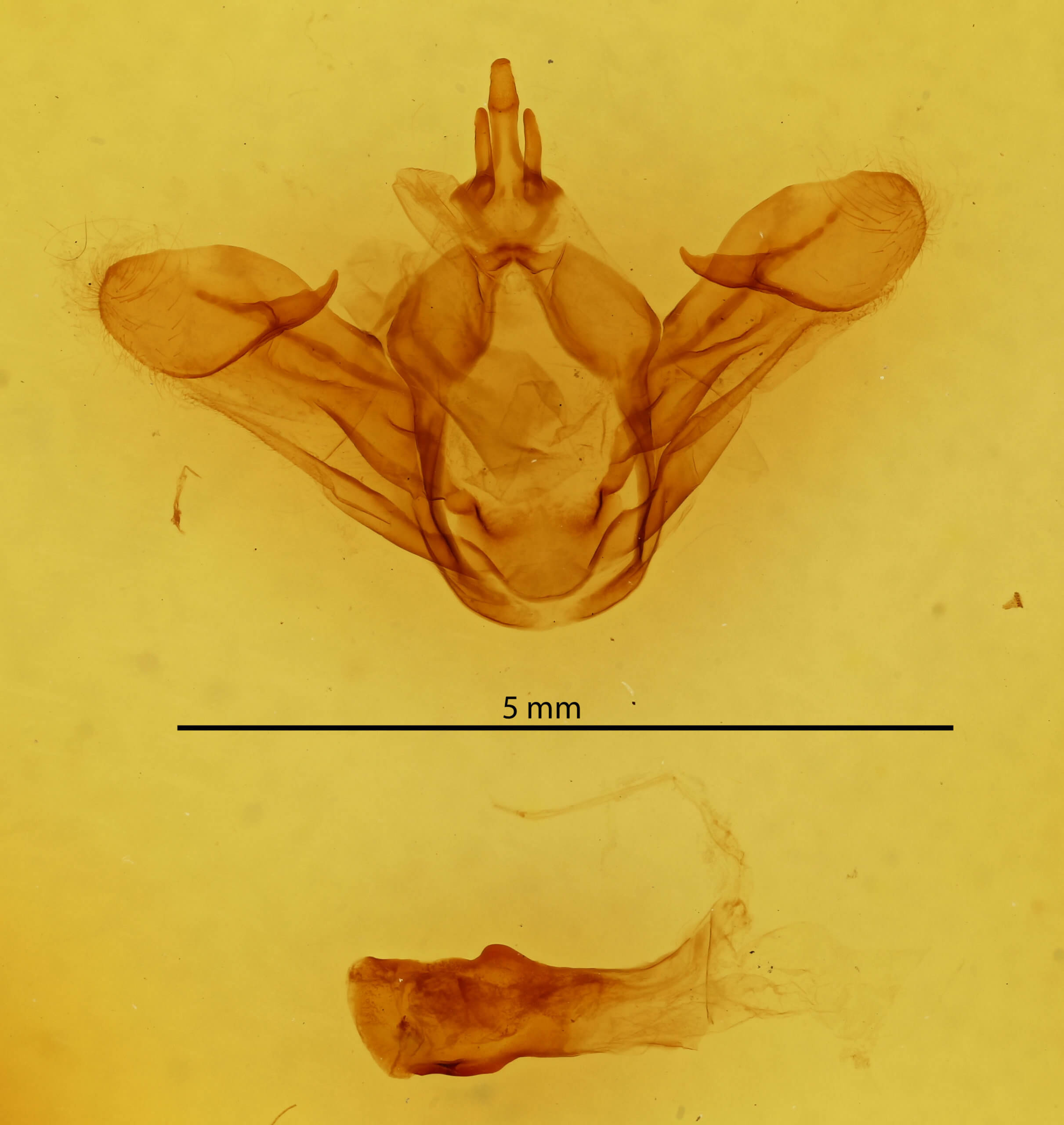 genitalia view of adult Leucodonta bicoloria