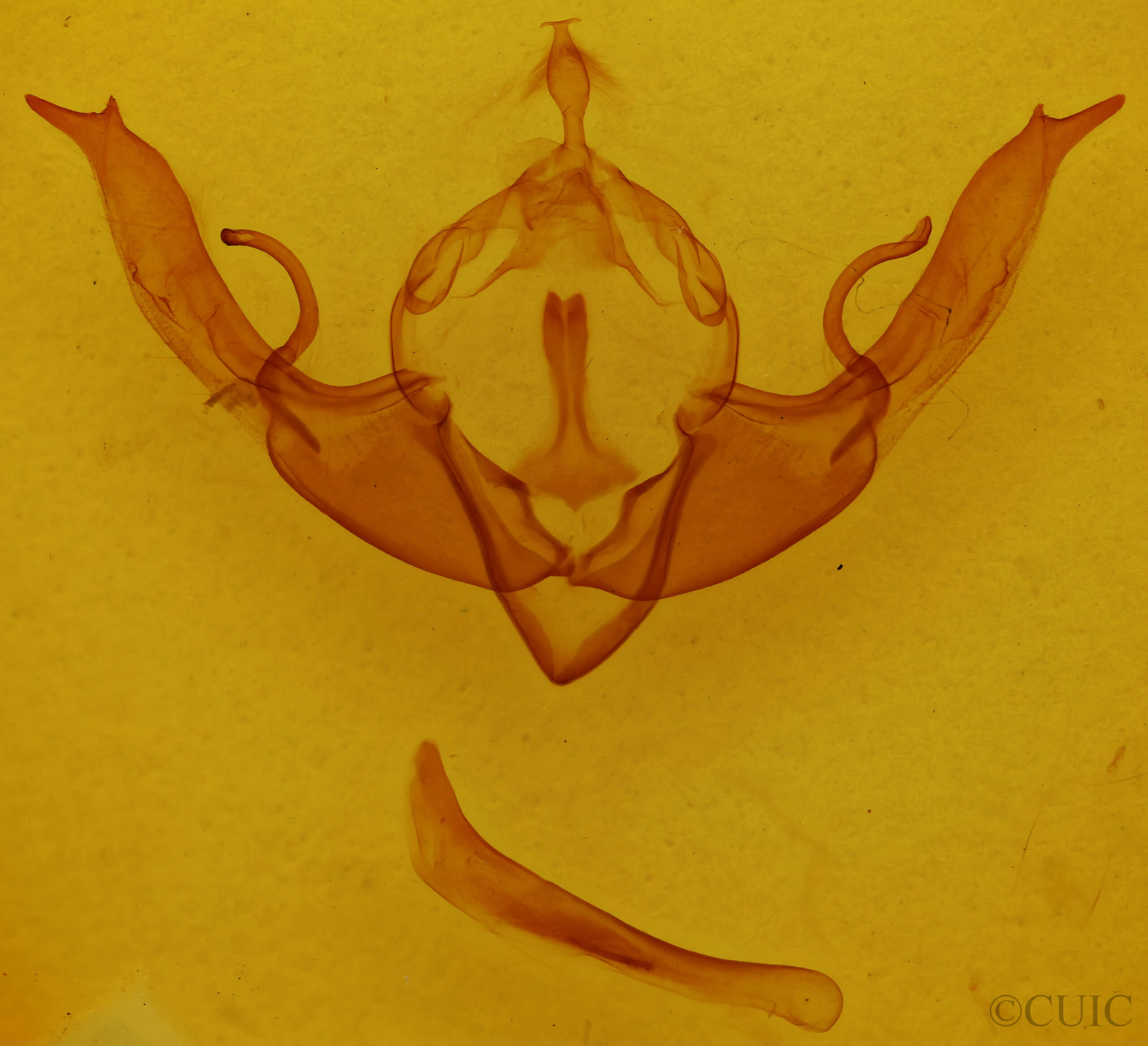 genitalia view of adult Lithophane pertorrida
