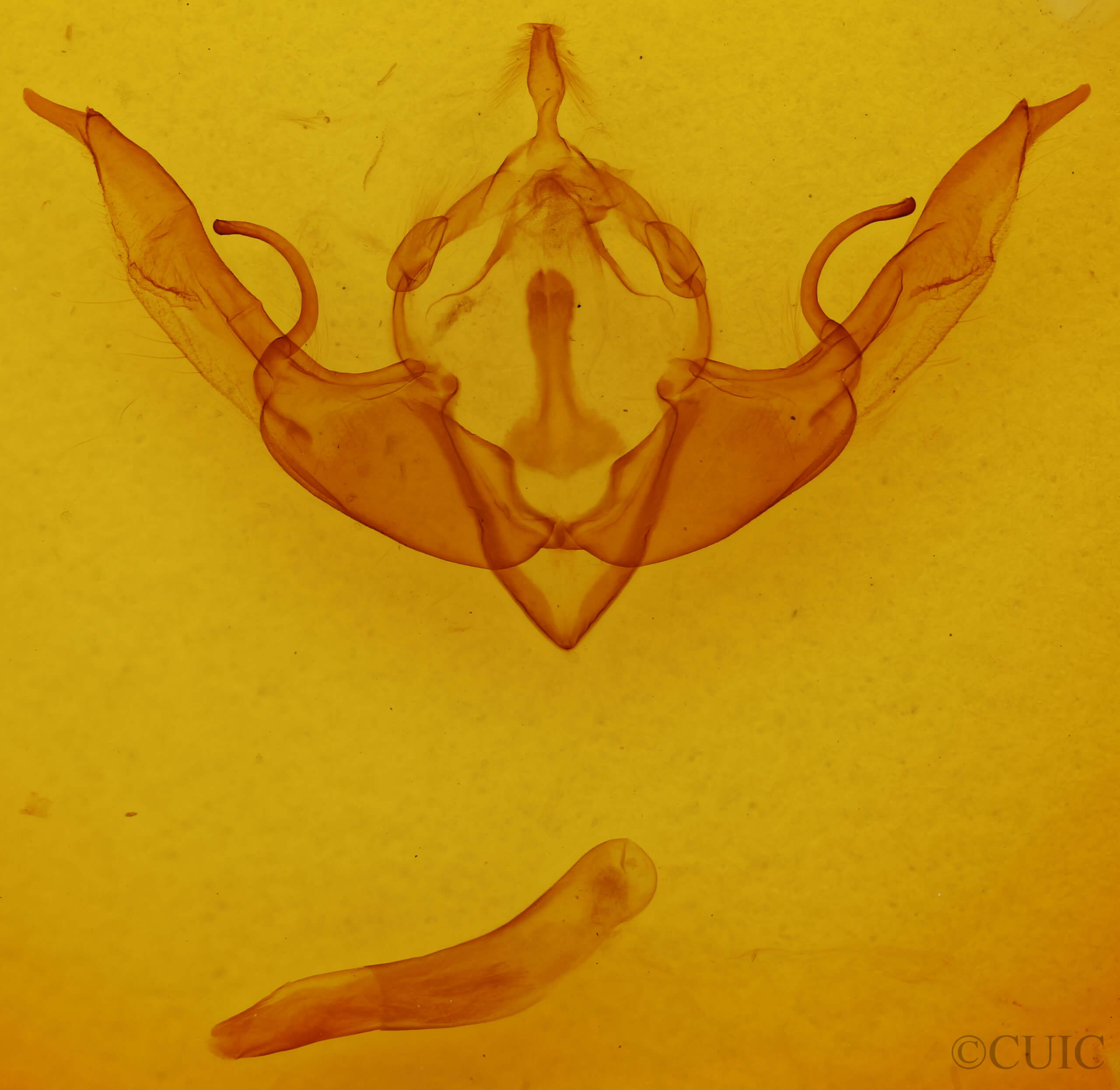 genitalia view of adult Lithophane pertorrida