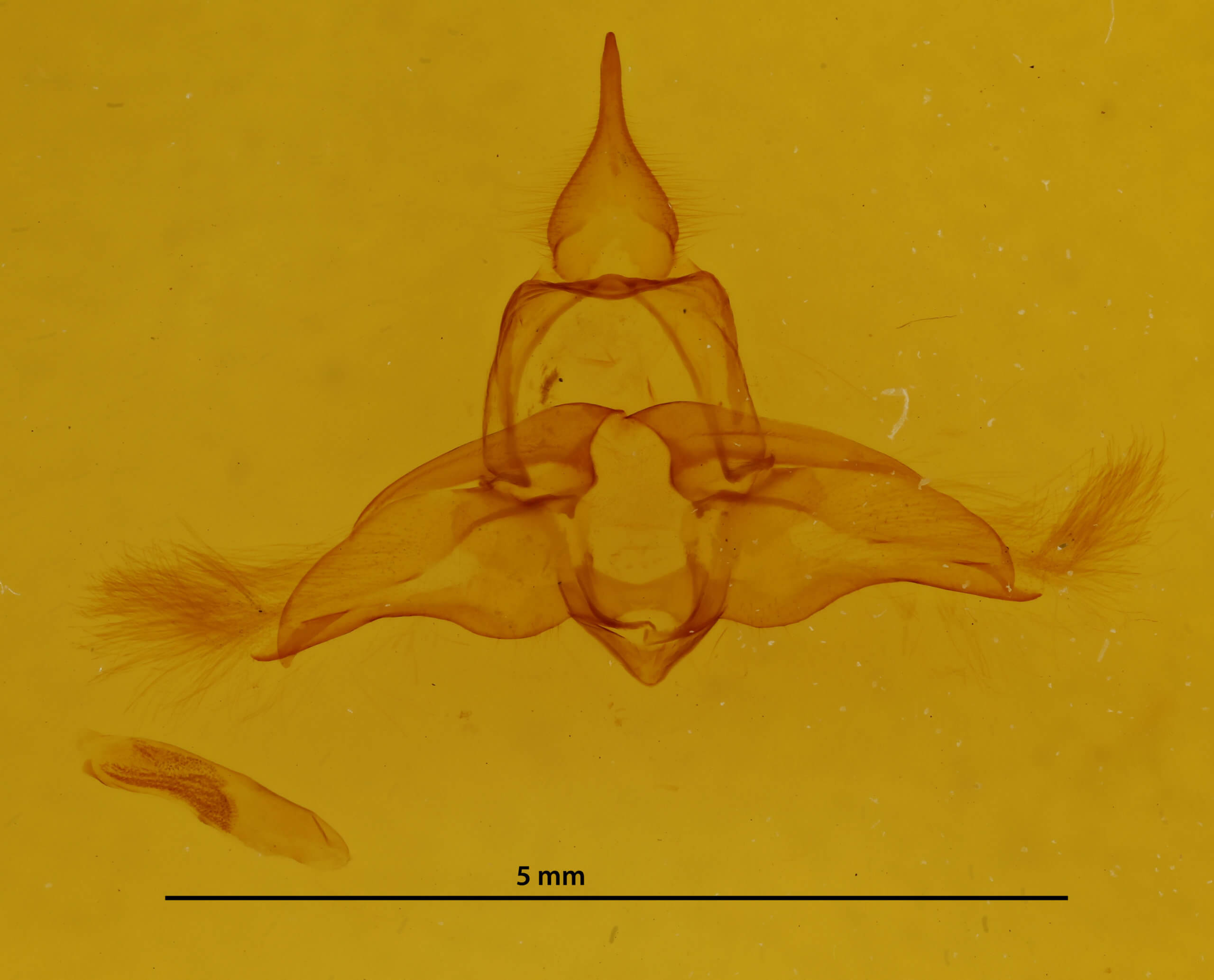 genitalia view of adult Lophocampa roseata