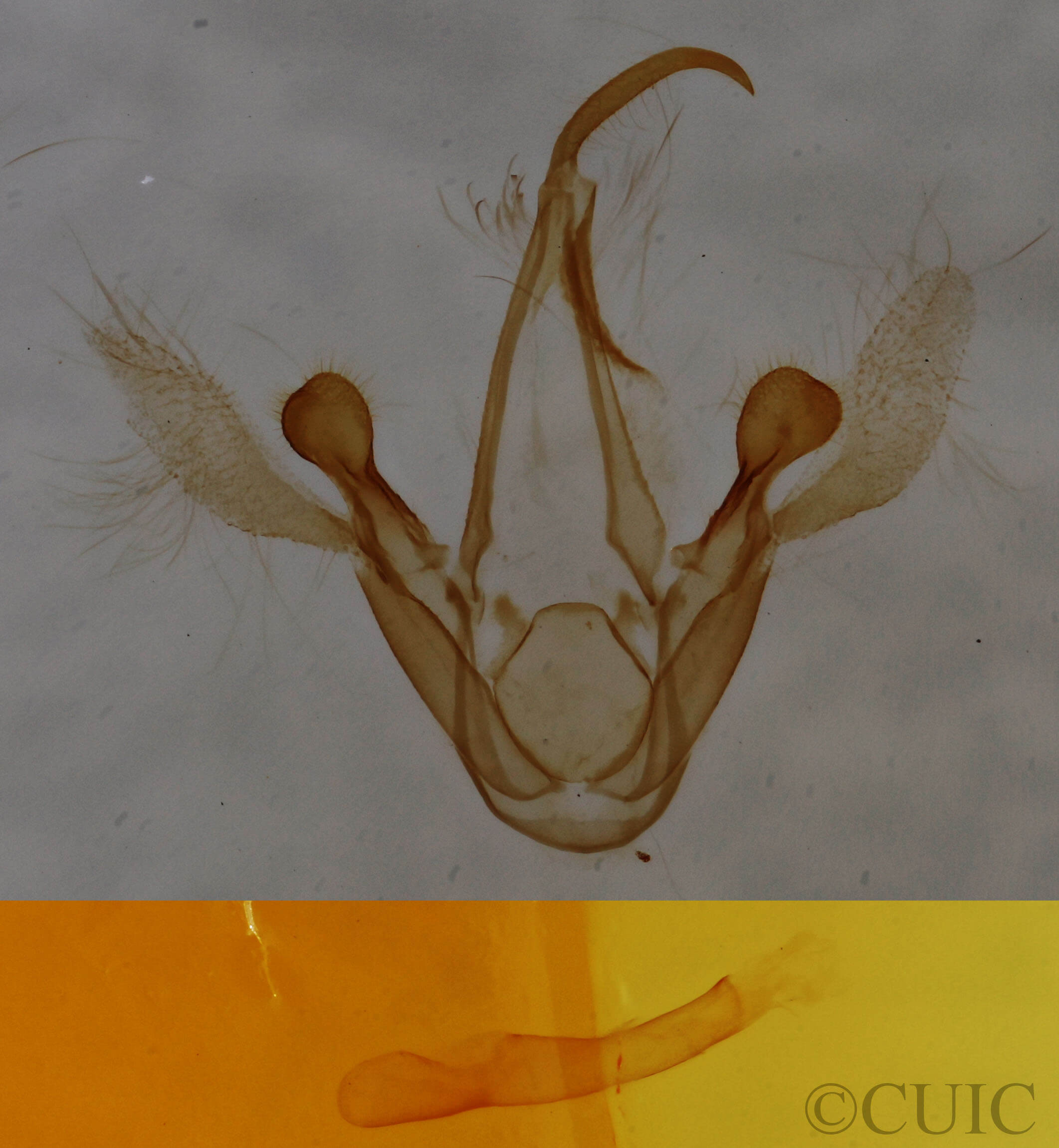 genitalia view of adult Metalectra richardsi